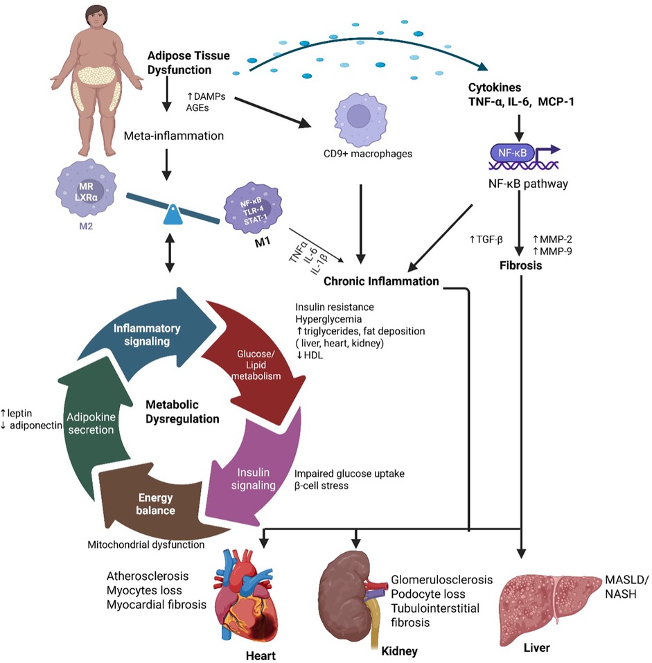 Flowchart illustrating metabolic dysregulation and its effects on the heart, kidney, and liver. Adipose tissue dysfunction leads to meta-inflammation, activating CD9+ macrophages and the NF-kB pathway, contributing to chronic inflammation. This results in insulin resistance, hyperglycemia, and increased triglycerides. Metabolic dysregulation impacts inflammatory signaling, glucose metabolism, insulin signaling, and energy balance. Consequences include atherosclerosis and myocardial fibrosis in the heart, glomerulosclerosis in the kidney, and MASLD/NASH in the liver.