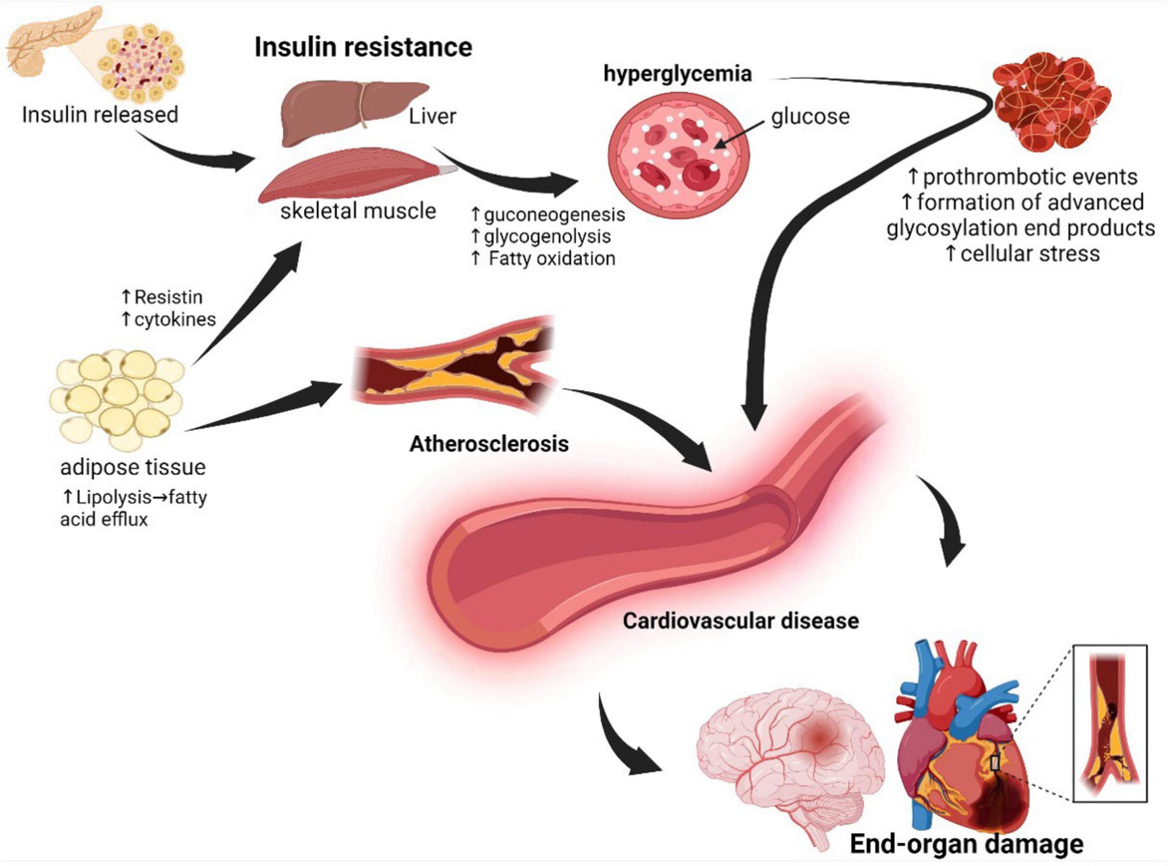 Flowchart illustrating the effects of insulin resistance, leading to hyperglycemia and atherosclerosis. Insulin resistance affects the liver and skeletal muscles, increasing gluconeogenesis, glycogenolysis, and fatty oxidation. In adipose tissue, it raises resistin and cytokines, enhancing lipolysis and fatty acid efflux. Resulting hyperglycemia and prothrombotic events contribute to advanced glycosylation and cellular stress. These processes lead to atherosclerosis, resulting in cardiovascular disease and end-organ damage affecting the brain and heart.