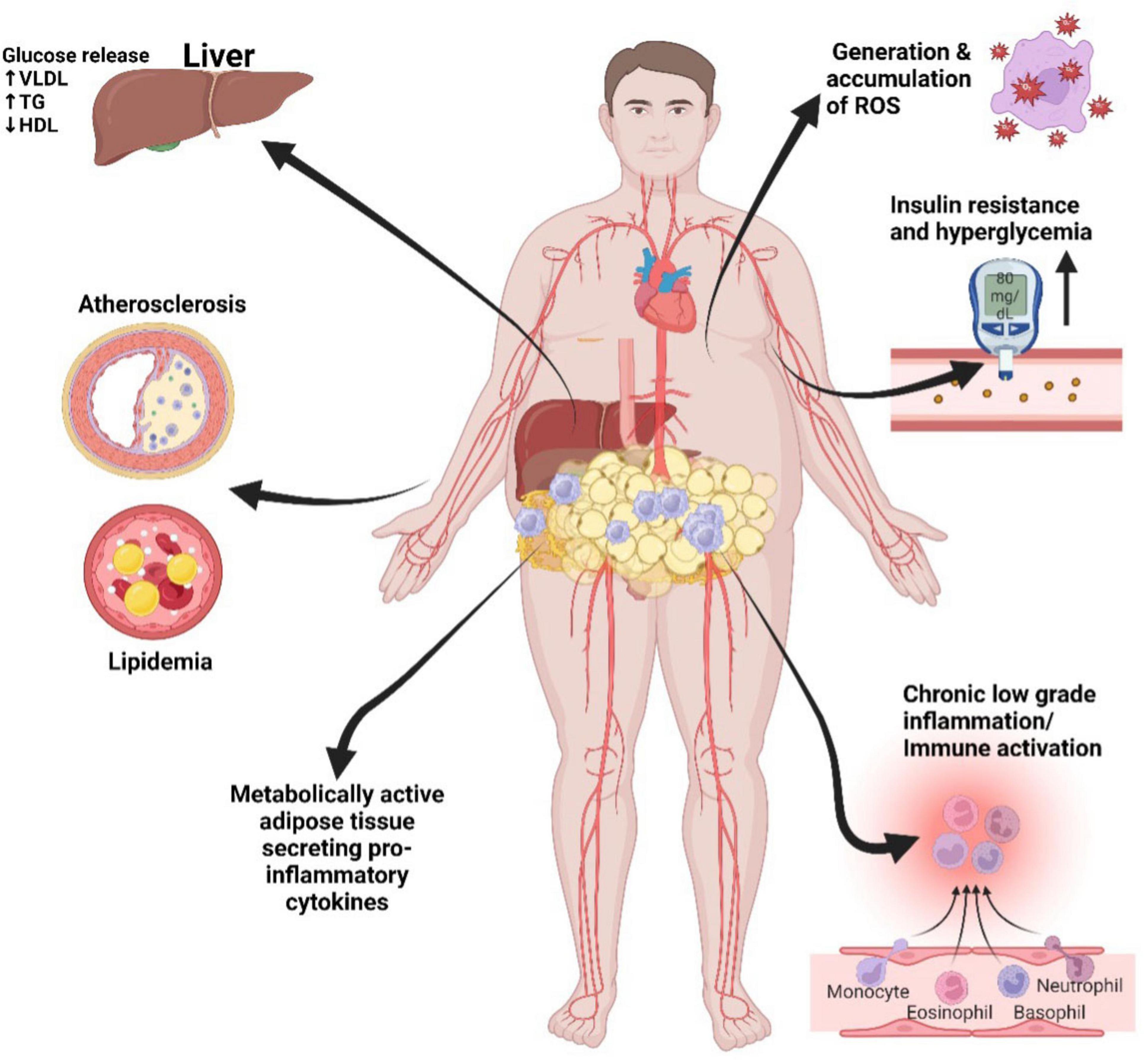 Illustration of a human body with a focus on metabolic and inflammatory processes associated with obesity. Key features include the liver’s glucose release and VLDL, TG increase, and HDL decrease. Arrows point to atherosclerosis and lipidemia. Additional arrows lead to the generation and accumulation of reactive oxygen species, insulin resistance, hyperglycemia, and chronic low-grade inflammation with immune activation. Metabolically active adipose tissue secreting pro-inflammatory cytokines is highlighted in the abdominal region.