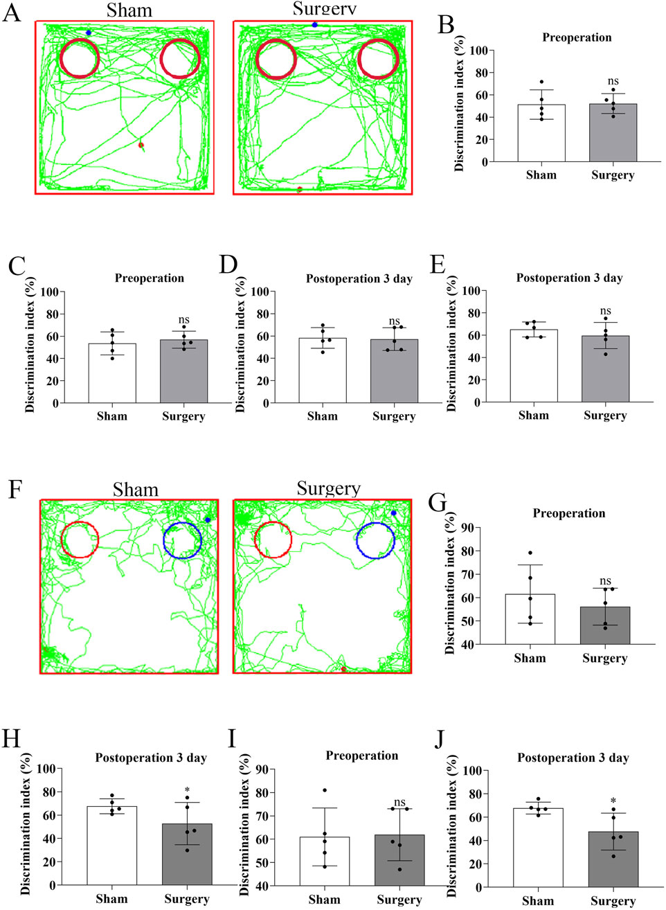 Experimental results show schematic diagrams and bar graphs comparing the discrimination index between sham and surgery groups. Panels A and F feature trajectories of subjects, while panels B, C, D, E, G, H, I, and J display bar graphs measuring pre-operation and post-operation indices. Data points with standard deviations are provided, showing no significant differences (ns) except for some panels indicating significance with an asterisk.