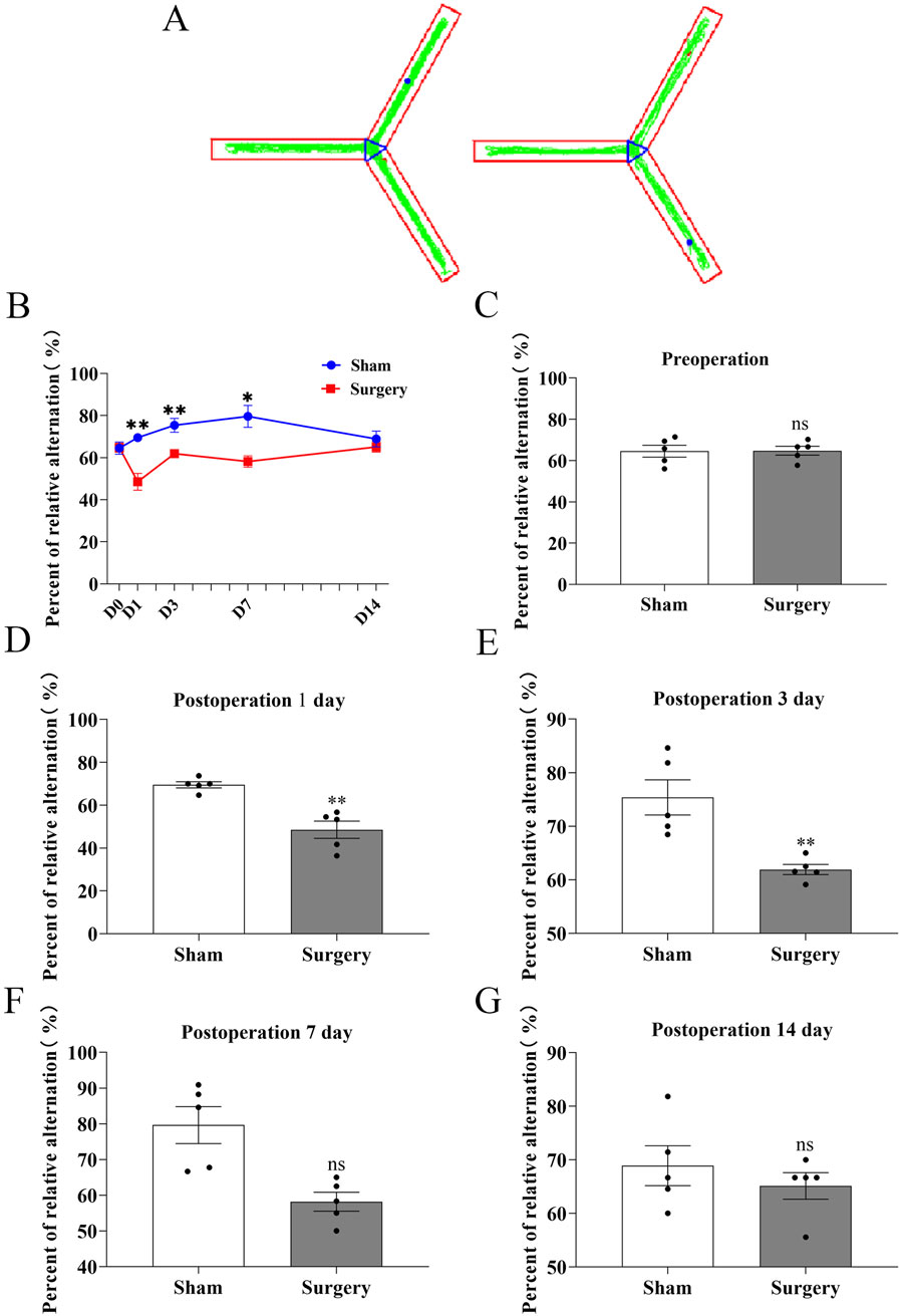 Panel A shows two diagrams of Y-mazes with paths highlighted. Panel B is a line graph comparing the percent of relative alternation between sham and surgery groups over different days, showing higher alternation in the sham group. Panels C to G are bar graphs showing percent of relative alternation preoperation and various days postoperation, with the sham group consistently higher. Statistical significance is noted with asterisks.