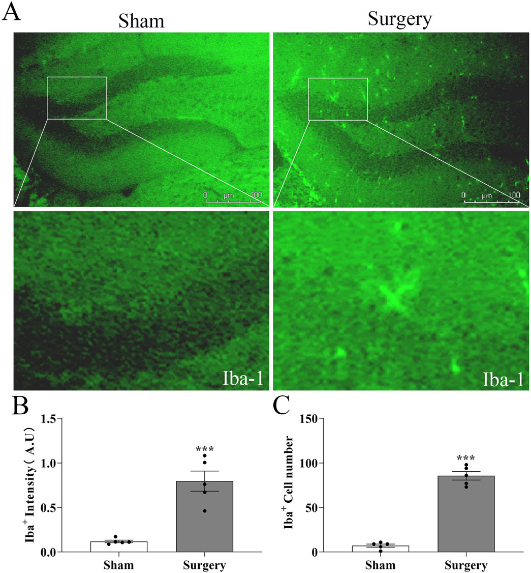 Panel A shows fluorescence microscopy images comparing Iba-1 expression in brain tissues from sham and surgery groups, highlighting increased expression in surgery. Panel B presents a bar graph of Iba-1 intensity in arbitrary units (A.U.), with significantly higher intensity in the surgery group. Panel C displays a bar graph indicating the number of Iba-1 positive cells, also significantly higher in the surgery group. Both graphs show statistical significance with three asterisks indicating P < 0.001.