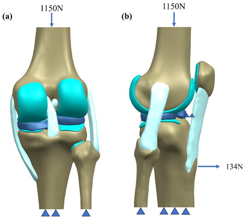 Illustration showing two views of a knee joint: (a) anterior view and (b) lateral view. Both display forces acting on the joint with arrows indicating 1150 Newtons downward and 134 Newtons horizontally in (b). Various components of the knee structure are highlighted in blue and teal.