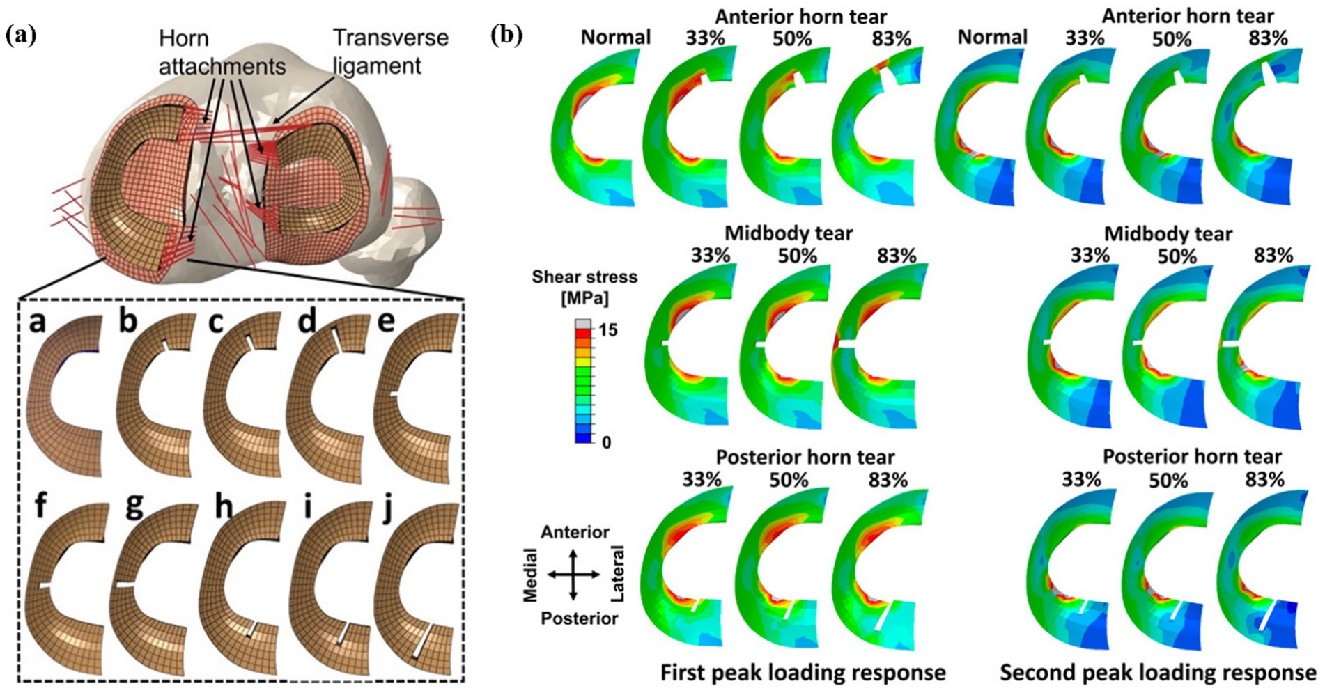 Diagram (a) shows a detailed medial meniscus with horn attachments and the transverse ligament. Close-up views illustrate various tear patterns labeled a to j. Diagram (b) presents color-coded models indicating shear stress in megapascal during first and second peak loading responses for different tear types: anterior horn, midbody, and posterior horn tears at 33%, 50%, and 83%. Arrows define anterior-posterior and medial-lateral directions, with a scale showing stress levels from 0 to 15 megapascal.