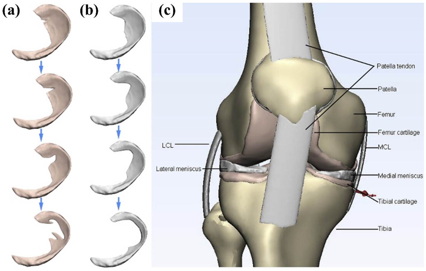 (a) A series of three brown crescent shapes illustrating the degradation of the medial meniscus. (b) Corresponding gray shapes showing further wear. (c) Diagram of a knee joint with labels for the patella tendon, patella, femur, femur cartilage, MCL, medial meniscus, tibial cartilage, tibia, LCL, and lateral meniscus.