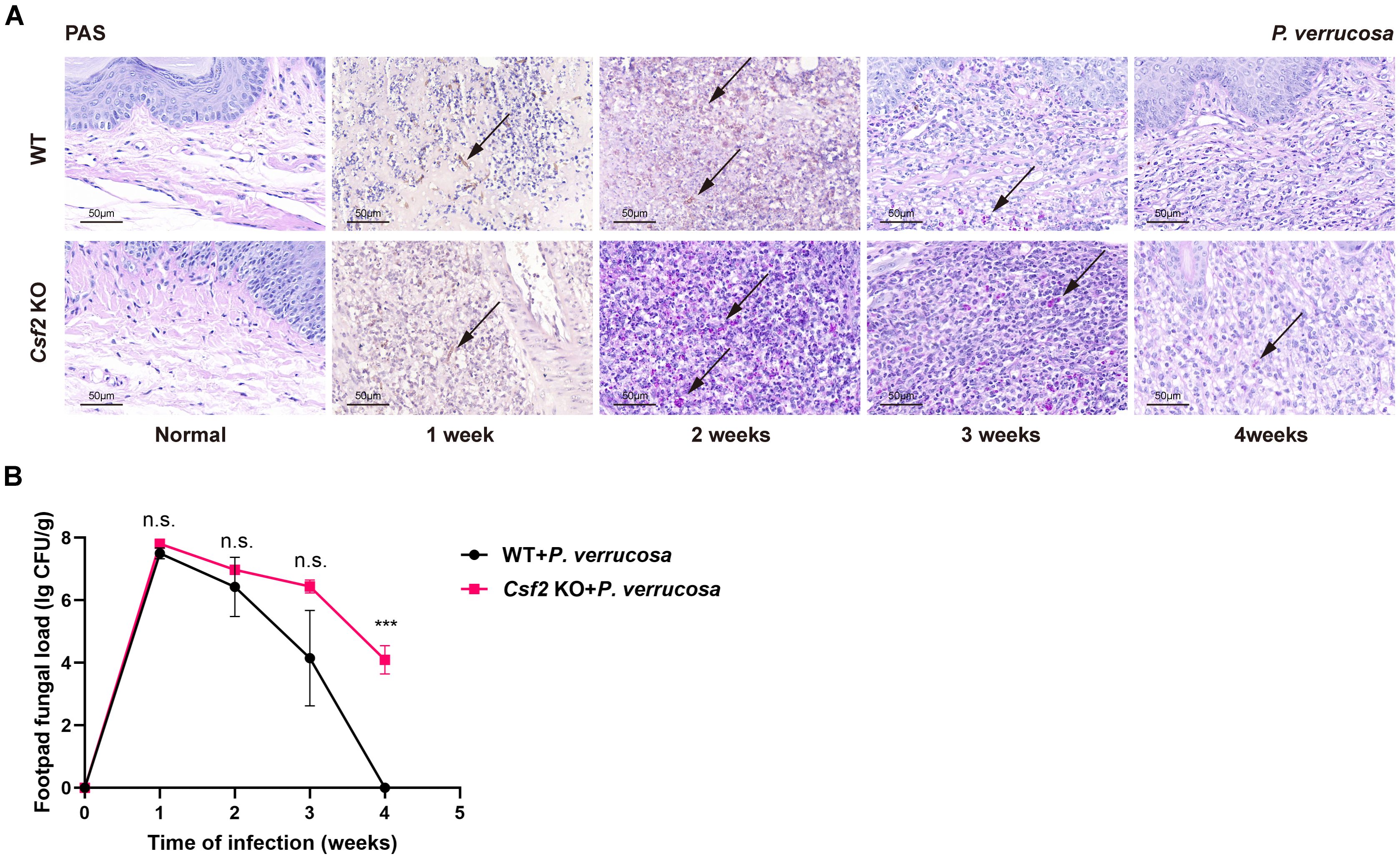 Panel A shows PAS-stained microscopic images of skin tissue from WT and Csf2 KO mice over four weeks after infection with P. verrucosa, with arrows indicating fungal presence. Panel B is a line graph comparing footpad fungal load over time between WT and Csf2 KO mice infected with P. verrucosa. The fungal load is higher in Csf2 KO mice, particularly at four weeks. Significant differences are marked with asterisks.