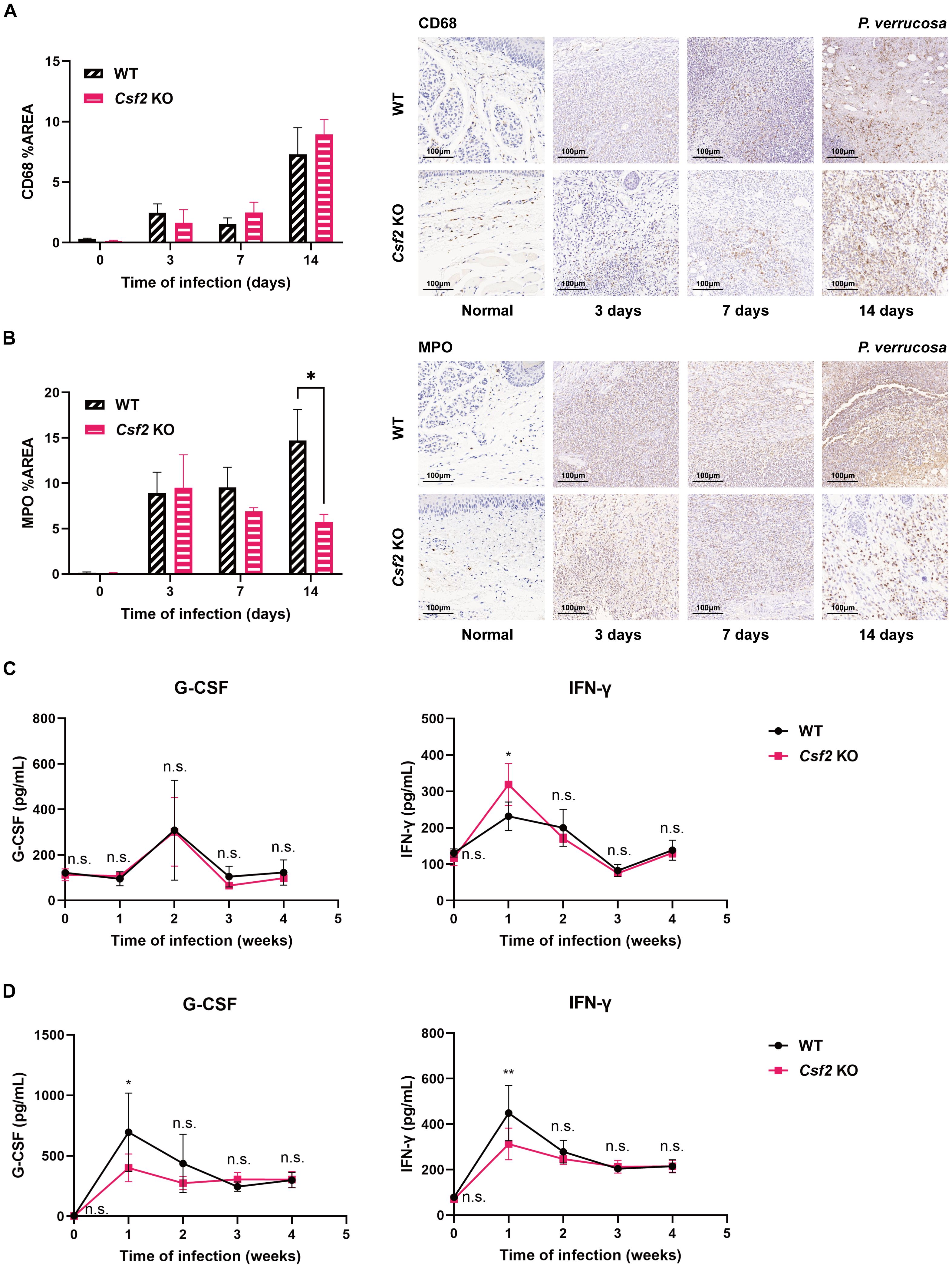 Bar graphs and histological images comparing WT and Csf2 KO mice. (A) CD68 staining shows similar macrophage infiltration over 14 days post-infection. (B) MPO staining reveals significant neutrophil presence at day 14 in WT. (C) IFN-γ levels in footpad homogenates of WT and Csf2 KO mice, peaking at one week post-infection. (D) G-CSF and IFN-γ  levels in serum with significant differences at week 1, notably higher in WT. Statistical significance is marked with asterisks.