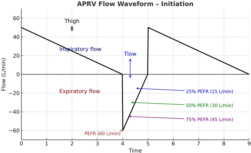 APRV flow waveform graph depicting initiation. The y-axis shows flow in liters per minute from -60 to 60, and the x-axis shows time from 0 to 9. Inspiratory and expiratory flows are marked. Thigh and Tlow indicate flow phases. Three points, 25% (15 L/min), 50% (30 L/min), and 75% (45 L/min) of PEFR, are labeled. PEFR is noted at -60 L/min.