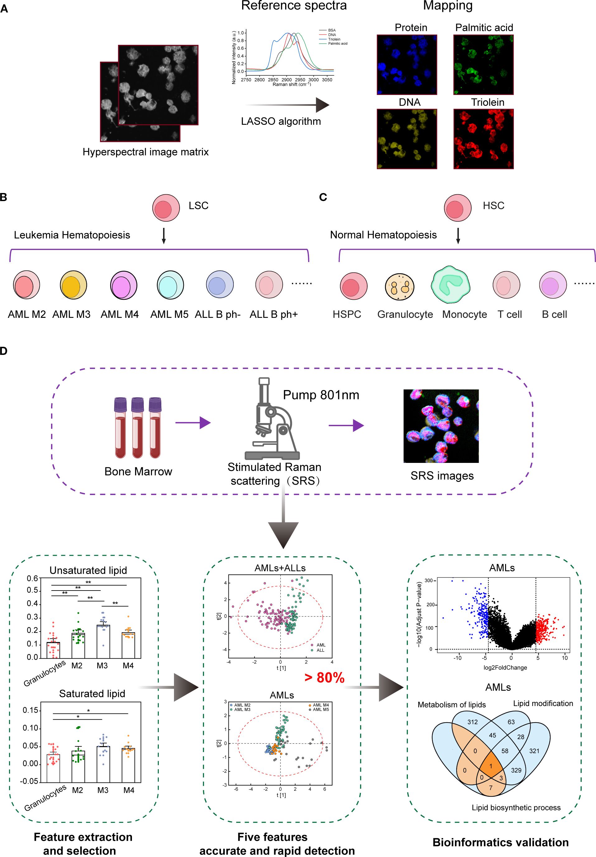 Flowchart illustrating a methodology for leukemia and normal hematopoiesis detection using hyperspectral imaging and Raman scattering. Panel A shows the process of hyperspectral imaging, reference spectra, and algorithm mapping for molecular identification. Panel B outlines leukemia hematopoiesis stages with cells such as AML and ALL. Panel C depicts normal hematopoiesis stages including HSPCs and various blood cells. Panel D demonstrates the process from bone marrow sampling to stimulated Raman scattering, leading to feature extraction for accurate detection and bioinformatics validation, represented by charts and diagrams analyzing lipid metabolism and biosynthesis.