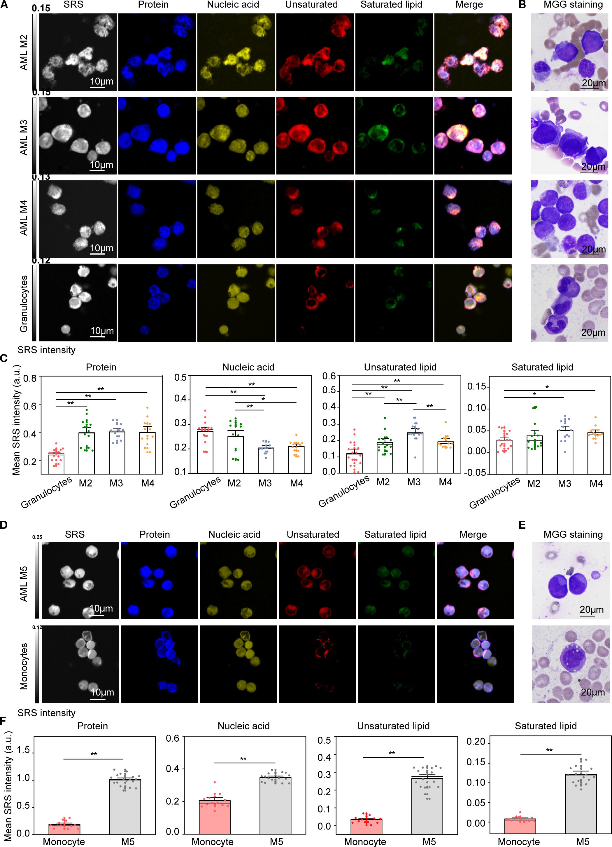 Panels show microscopic and stained images of cells at different stages (AML M2, M3, M4, M5, granulocytes, monocytes) highlighting proteins, nucleic acids, unsaturated and saturated lipids, with merged images. Adjacent bar graphs display mean intensity data for each component, comparing different cell types. Staining patterns are visible on the right for MGG staining. Scale bars indicate magnification.