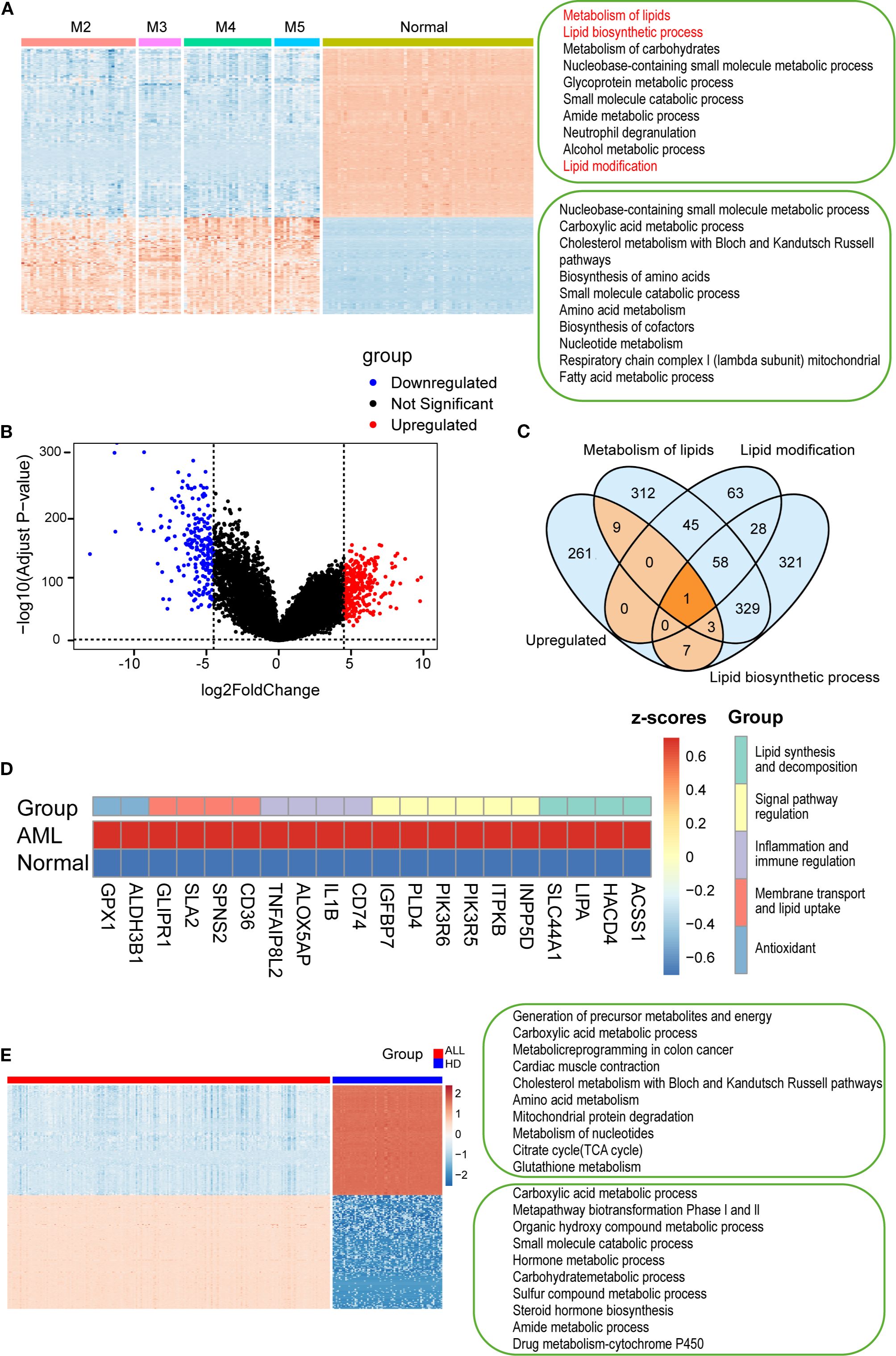 A series of data visualizations for gene expression analysis include a heatmap (A) showing gene expression across groups: M2, M3, M4, M5, and Normal; a volcano plot (B) depicting gene regulation with significant, upregulated, and downregulated genes; a Venn diagram (C) showing overlapping metabolic processes; a heatmap (D) illustrating expression in Acute Myeloid Leukemia (AML) vs. Normal, categorized by functional group; a heatmap (E) comparing ALL with HD, detailing metabolic pathways and gene expression levels.
