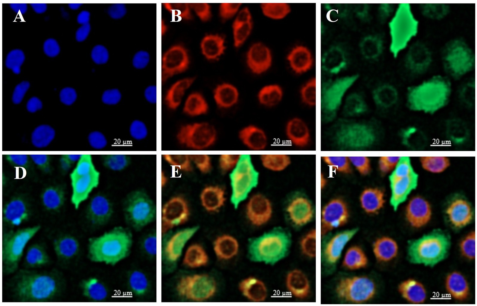 Microscopic images of cells shown in six panels. Panel A shows blue-stained nuclei, panel B shows red-stained cell membranes, and panel C shows green fluorescence in some cells. Panels D, E, and F are overlays; D combines blue and green, E combines red and green, and F combines all three colors, illustrating different cellular components. Each panel is labeled and includes a 20-micrometer scale bar.