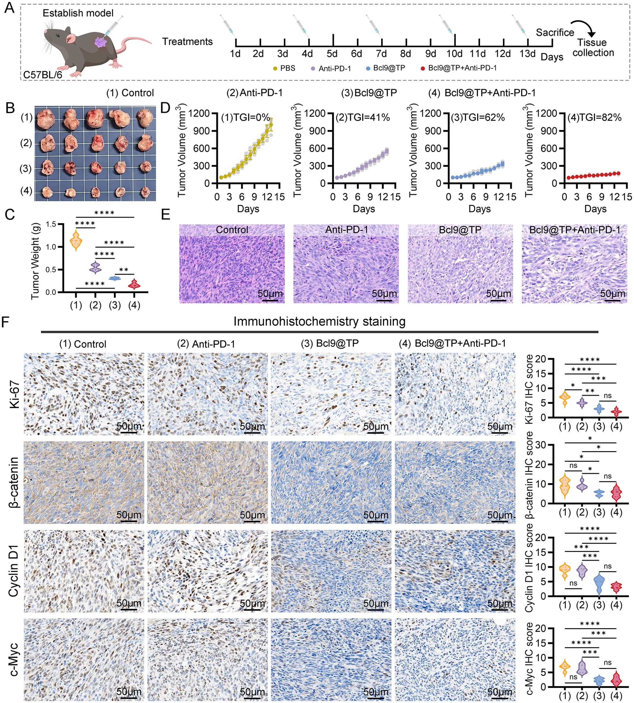 Diagram illustrating an experimental study on the effectiveness of different treatments on tumor growth in C57BL/6 mice. Panel A shows a timeline for treatments: PBS, Anti-PD-1, Bcl9@TP, and Bcl9@TP+Anti-PD-1, followed by sacrifice and tissue collection. Panel B displays images of tumors under four control conditions. Panel C shows a graph comparing tumor weight across conditions, with significant differences noted. Panel D contains graphs of tumor volume over time, with varying treatment effectiveness observed. Panel E includes histological images of tumor tissue under different treatments, highlighting cellular morphology. Panel F presents immunohistochemistry staining results for Ki-67, β-catenin, Cyclin D1, and c-Myc, with corresponding IHC scores displayed on the right.