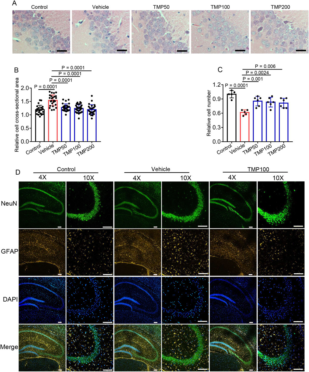 Panel A shows microscopic images of cells under different treatments: Control, Vehicle, TMP50, TMP100, and TMP200. Panel B is a bar graph illustrating the relative cell cross-sectional area across treatments, with significant p-values indicated. Panel C displays a bar graph of relative cell number with statistical significance. Panel D contains fluorescence images under two magnifications (4X and 10X) showing NeuN, GFAP, DAPI, and merged stains, comparing Control, Vehicle, and TMP100 groups.