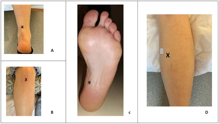 Line graph depicting passive stiffness in Newton meters per meter (N m⁻¹) against distance in kilometers. Achilles tendon stiffness decreases slightly from 850, patellar tendon maintains around 600, plantar fascia decreases from 440, while medialis gastrocnemius decreases gradually from 360.