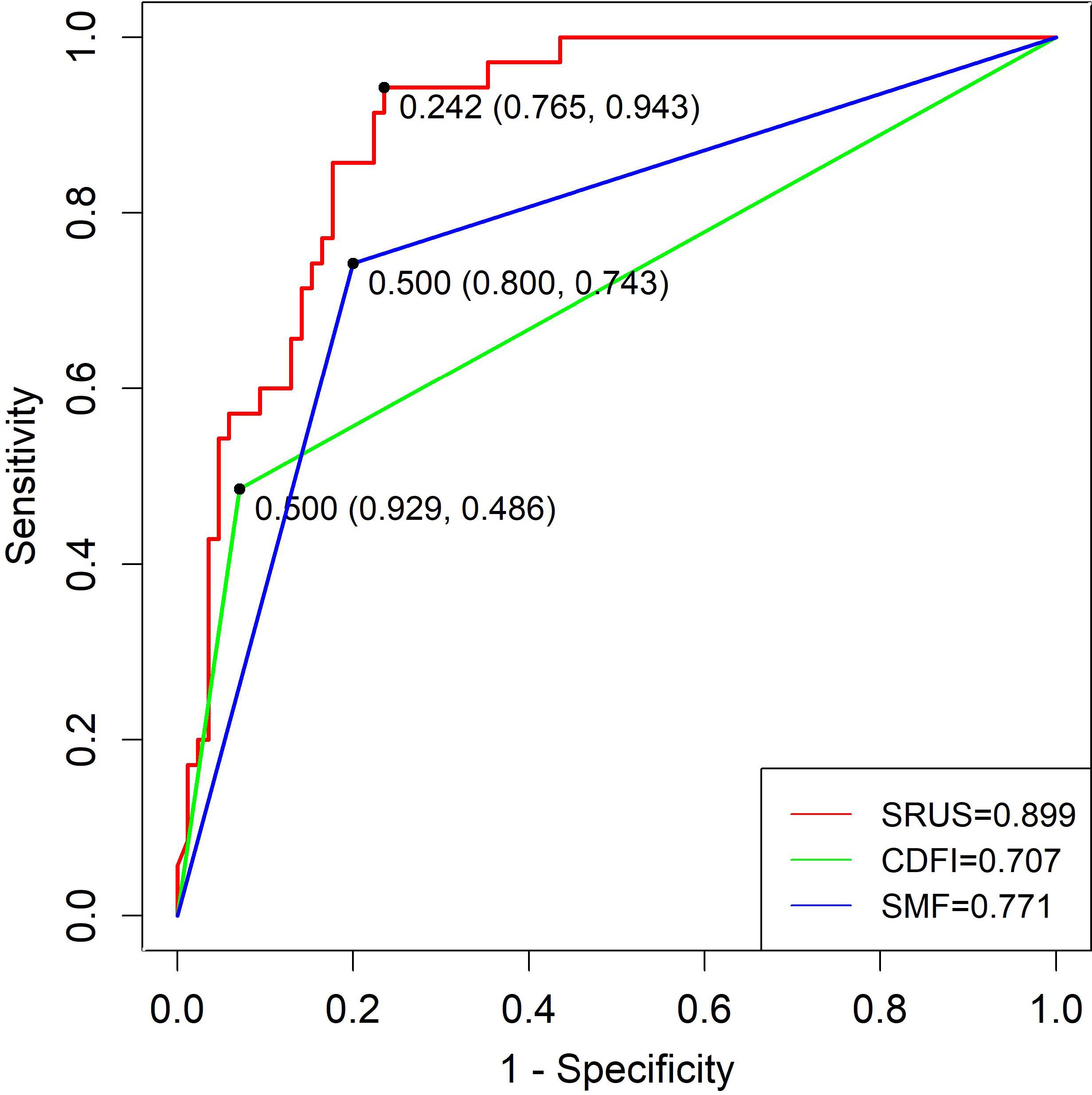 Receiver Operating Characteristic (ROC) curve comparing three models: SRUS, CDFI, and SMF. Sensitivity is plotted against 1-specificity. SRUS (red line) has the highest area under the curve (AUC) at 0.899, followed by SMF (blue line) with 0.771, and CDFI (green line) with 0.707. Black dots indicate specific data points on the curves.