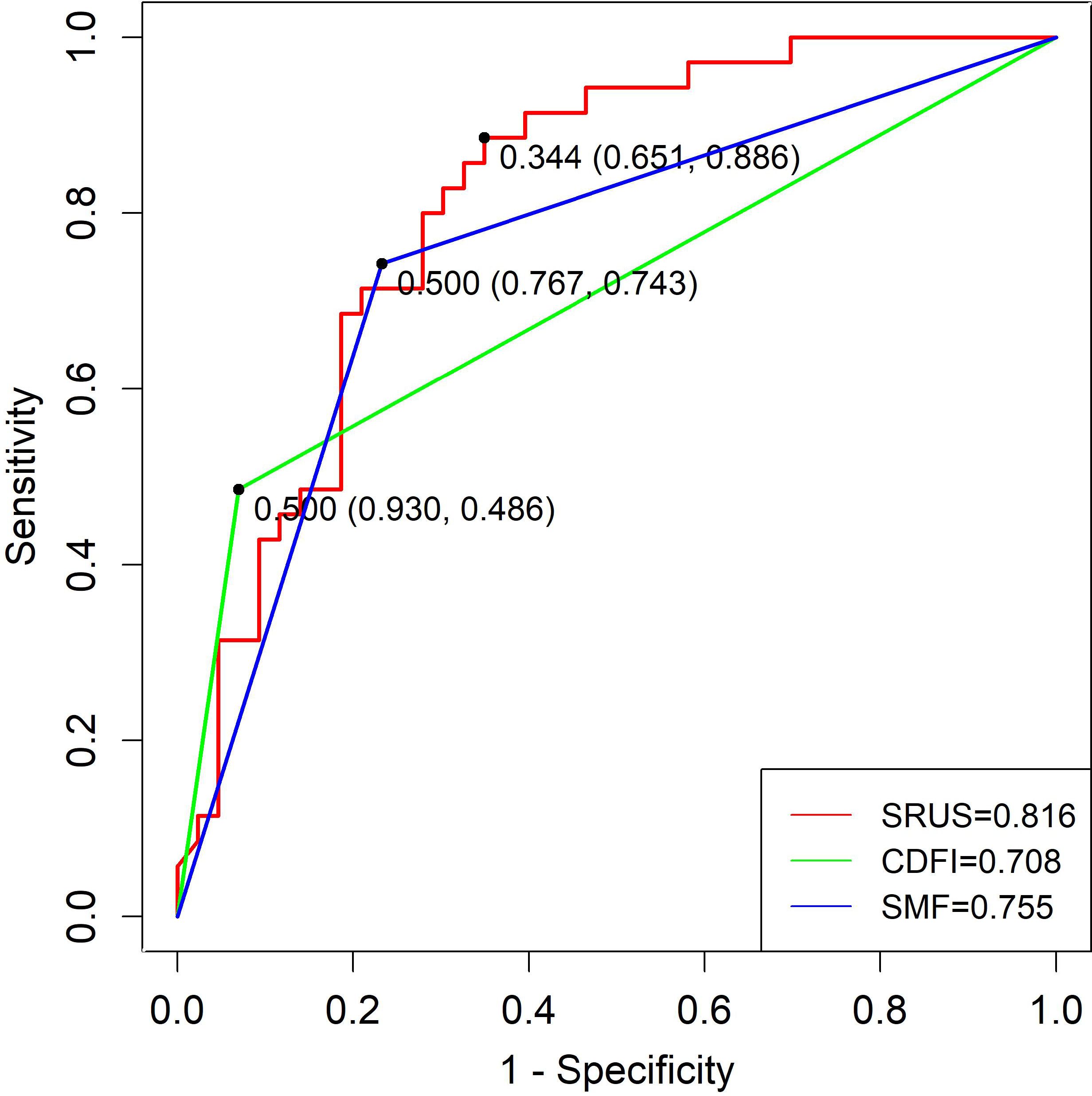 ROC curve graph showing sensitivity versus 1-specificity for three models: SRUS (red line, AUC = 0.816), CDFI (green line, AUC = 0.708), and SMF (blue line, AUC = 0.755). Data points with coordinates are marked on the curves.