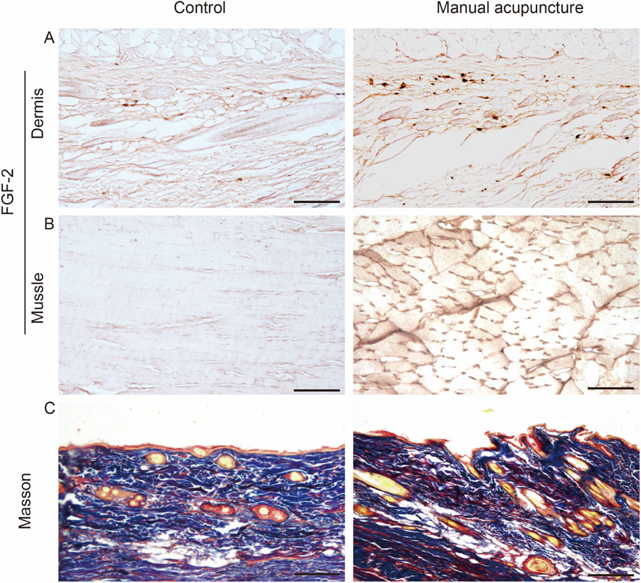 Histological images comparing control and manual acupuncture treatments in skin and muscle tissues. Panel A shows dermis staining with more intensity in acupuncture. Panel B displays muscle tissue, with acupuncture affecting fiber arrangement. Panel C illustrates Masson staining, highlighting significant differences in tissue structure between treatments.