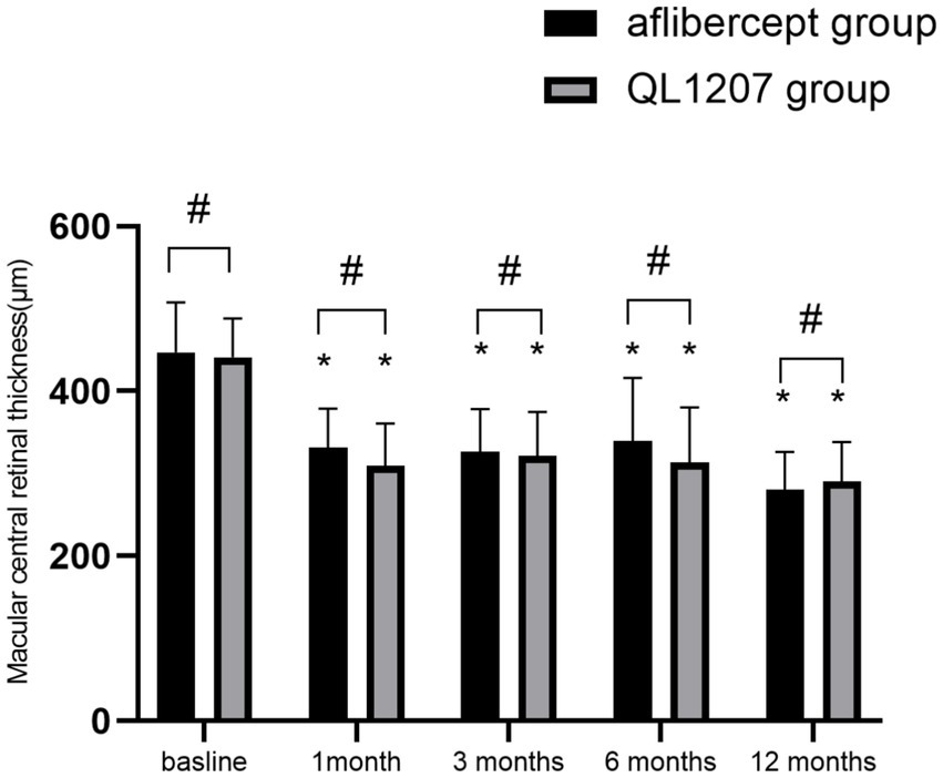Bar chart showing macular central retinal thickness over time for two groups: aflibercept (black) and QL1207 (gray). Measured at baseline, 1 month, 3 months, 6 months, and 12 months. Thickness decreases in both groups, with significant differences shown by asterisks and pound symbols.