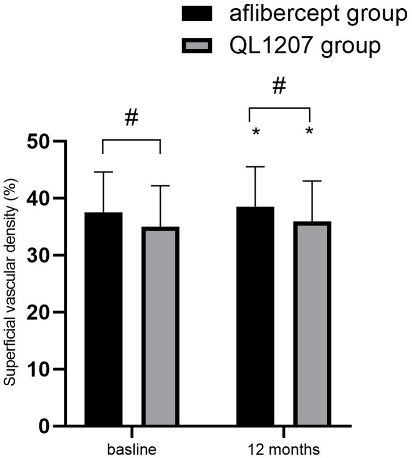 Bar graph comparing superficial vascular density percentages between aflibercept and QL1207 groups at baseline and after twelve months. Both groups show similar values at baseline. At twelve months, both groups exhibit significant increases, marked by asterisks, with the aflibercept group showing a slightly higher increase than QL1207.