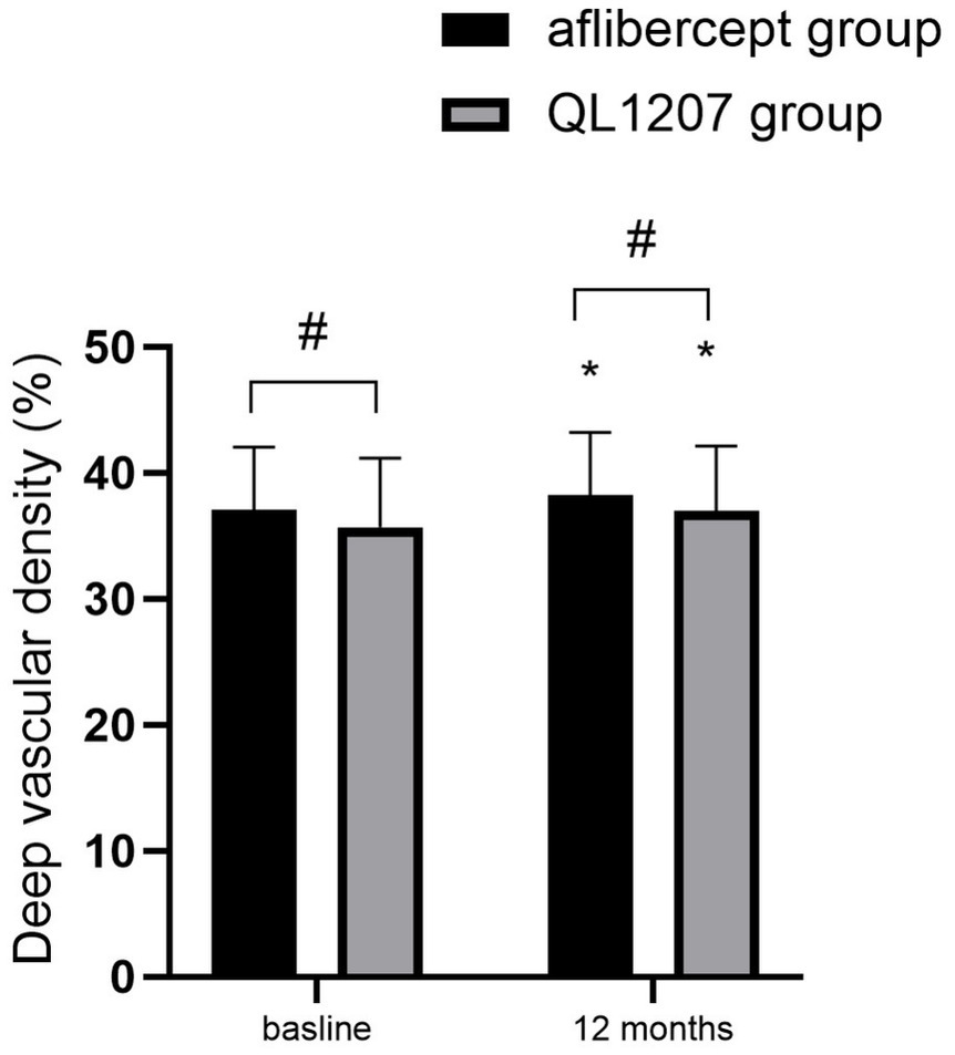 Bar graph comparing deep vascular density in percentage between aflibercept and QL1207 groups at baseline and after twelve months. Both groups show increased vascular density after twelve months, with significant differences indicated by asterisk and hash symbols.