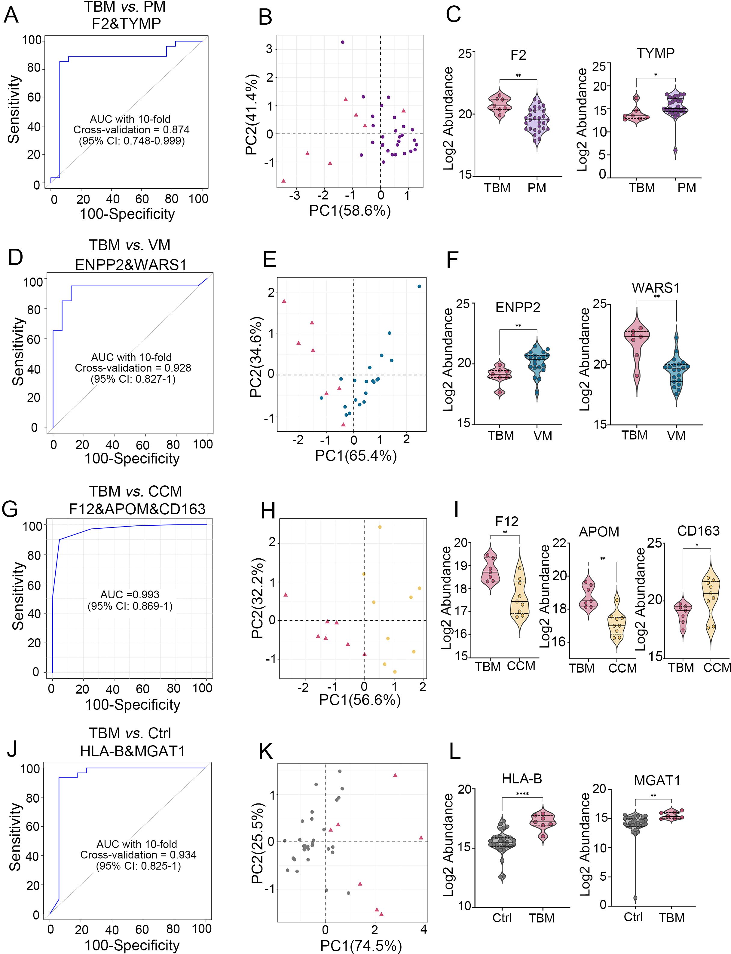 A series of panels comparing TBM with PM, VM, CCM, and Ctrl groups using different analyses. Panels A, D, G, and J show ROC curves with high AUC values, indicating strong predictive models. Panels B, E, H, and K present PCA plots illustrating variance between groups. Panels C, F, I, and L feature violin plots of log2 abundance for various proteins, highlighting differences between group pairings. All analyses demonstrate significant statistical differences.
