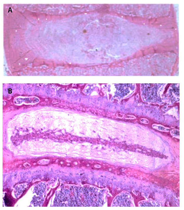 Histological images labeled A and B show tissue sections with different staining intensities. Image A depicts a uniformly stained section with lighter hues, while image B shows a section with distinct, darker staining patterns, highlighting structural details and textures.