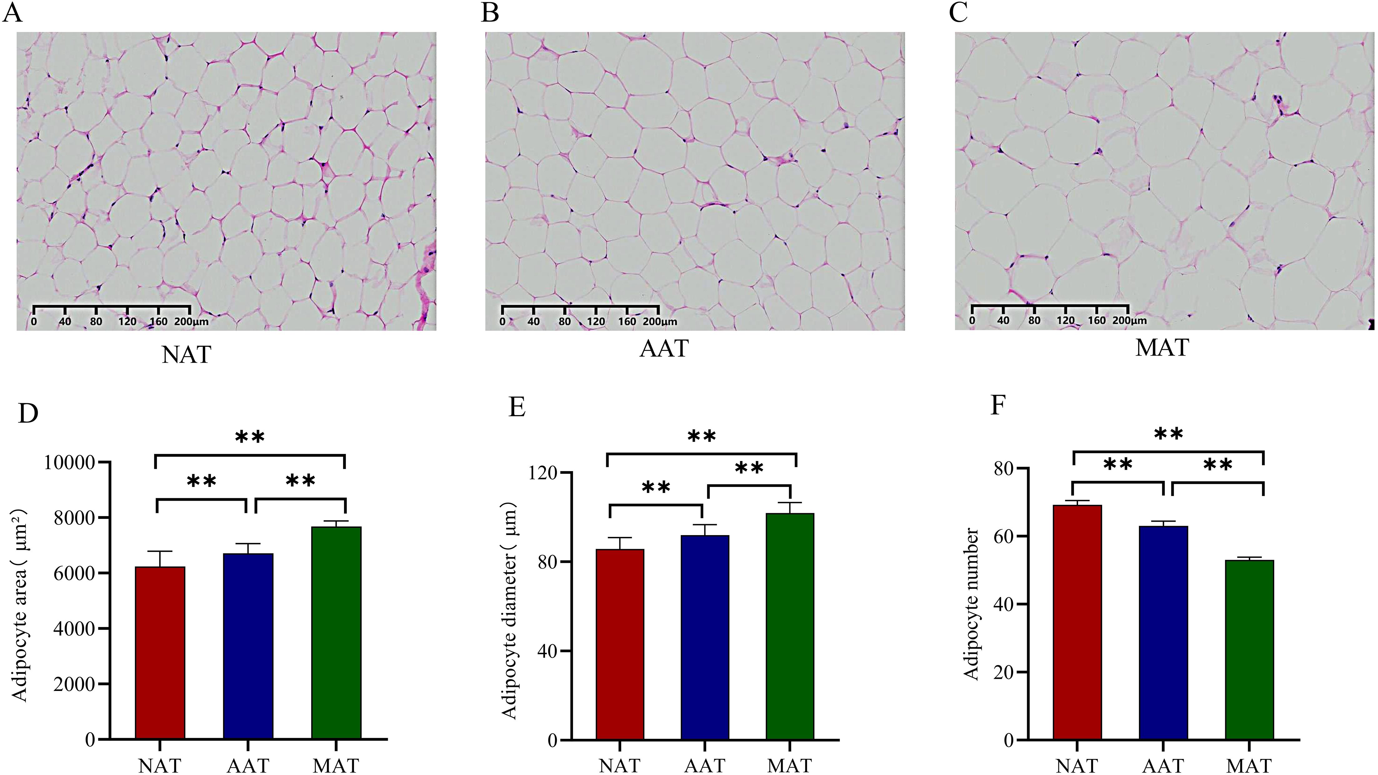 Histological images and bar charts comparing adipose tissue in different conditions. Panels A, B, and C show microscope images labeled NAT, AAT, and MAT, displaying varying cell sizes and distributions. Panels D, E, and F present bar charts indicating measurements for adipocyte area, diameter, and number across the same conditions, with significant differences marked by double asterisks.