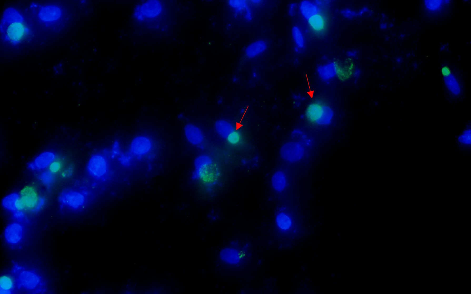 Microscopic view showing blue and green fluorescent cells against a dark background. Red arrows point to specific green-stained cells, indicating areas of interest.