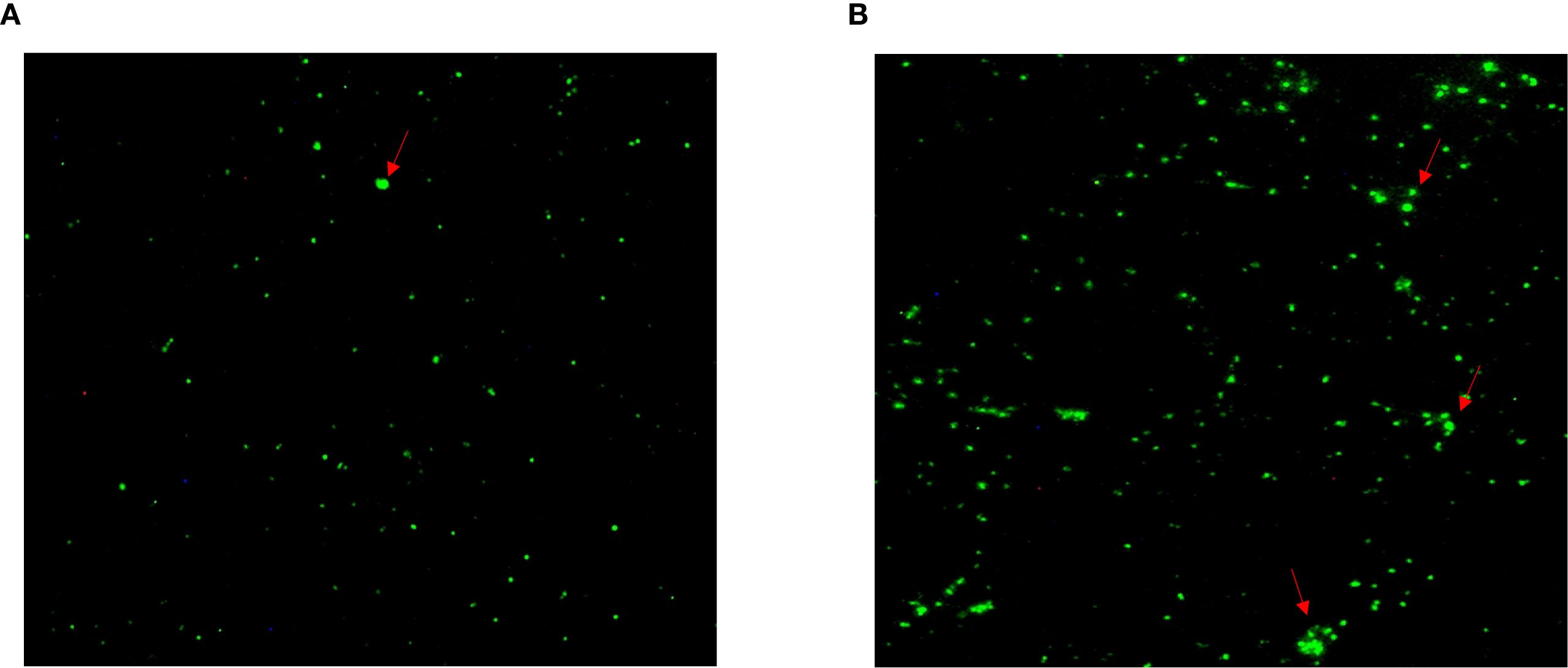Two fluorescence microscopy images labeled A and B. Image A shows scattered green fluorescent spots on a black background, with one spot indicated by a red arrow. Image B displays more numerous green spots, with two highlighted by red arrows, suggesting higher density or activity compared to image A.