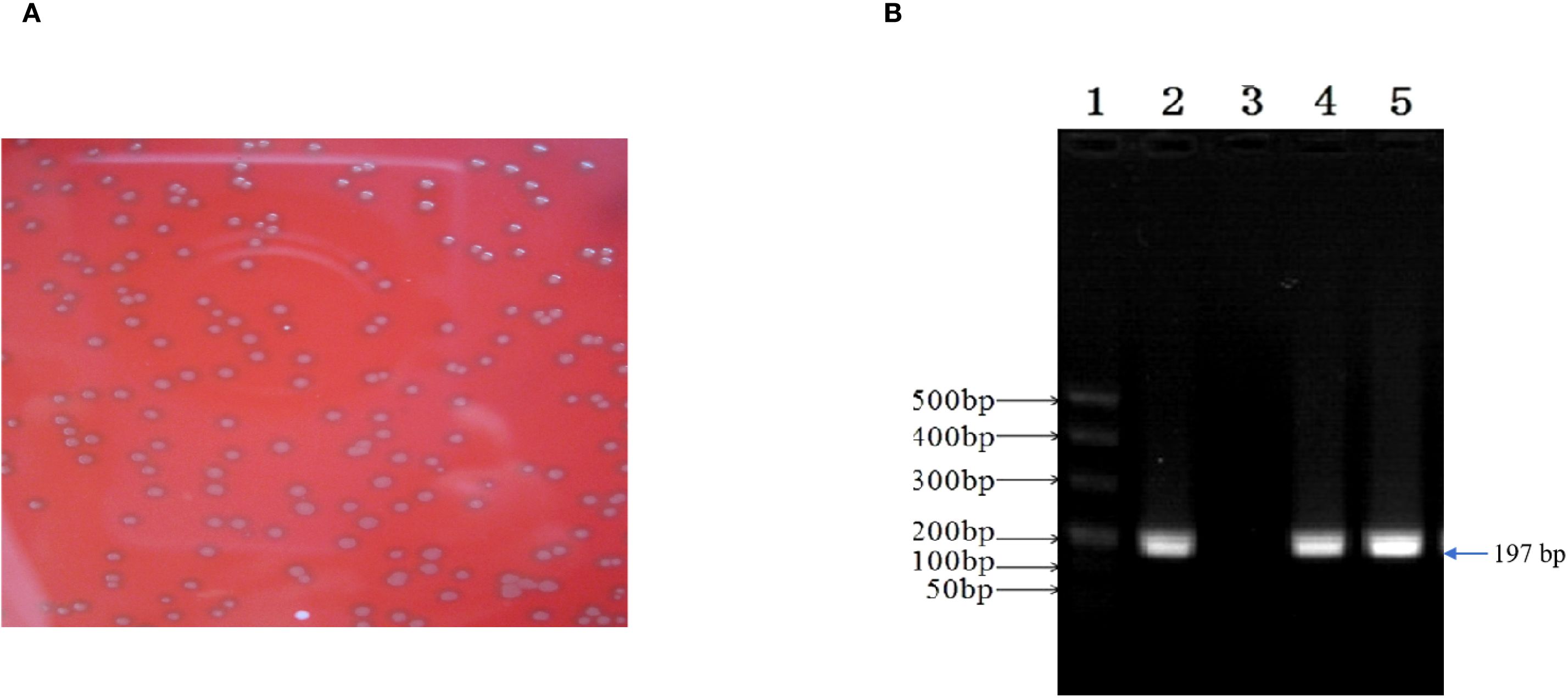 Panel A shows bacterial colonies on a red agar plate, indicating successful growth. Panel B displays a gel electrophoresis result with lanes showing DNA bands of varying lengths, with a prominent 197 base pair band highlighted in lane five.