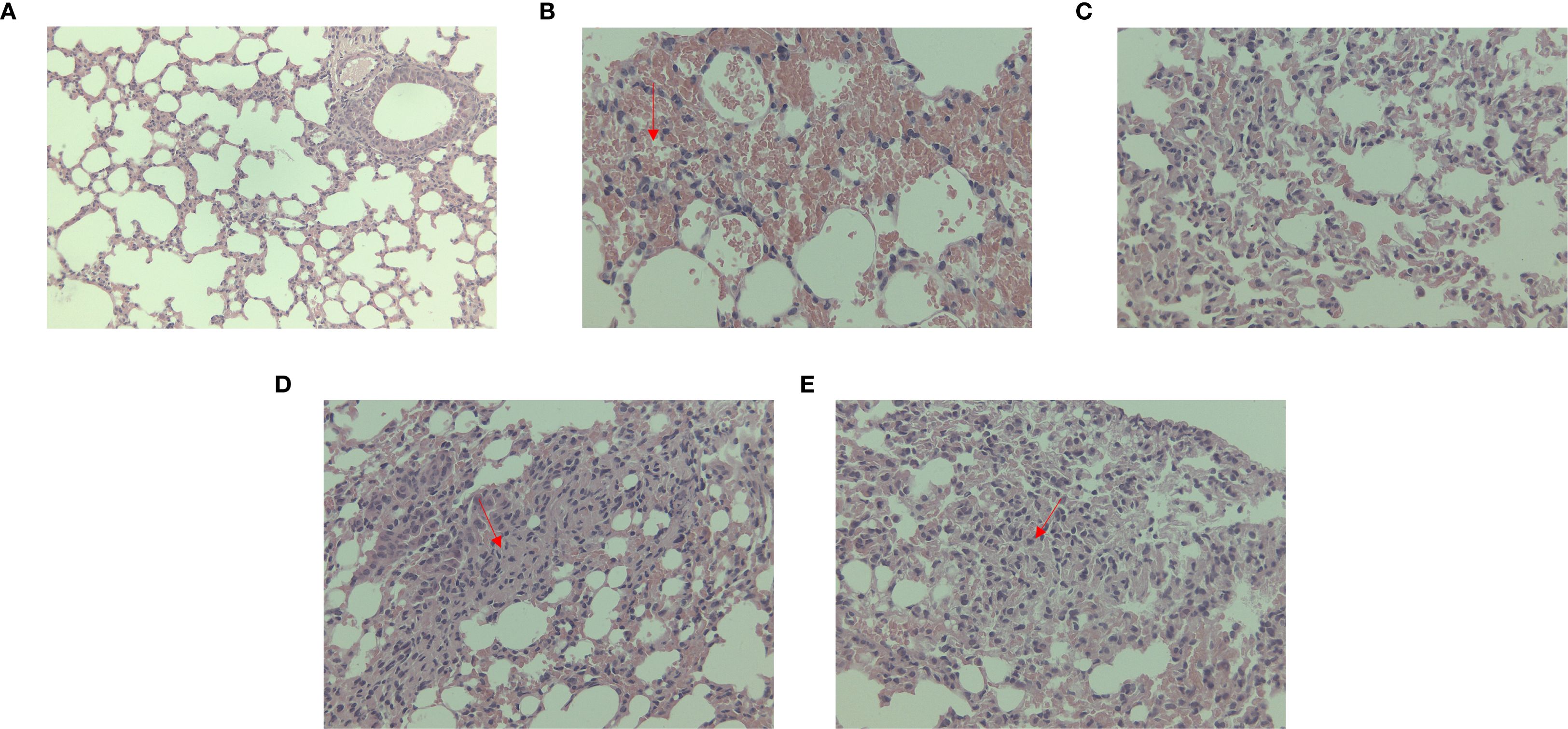 Histological images labeled A to E show lung tissue sections. Image A displays normal lung architecture. Images B to E depict varying degrees of tissue damage and inflammation, with highlighted areas marked by red arrows indicating focal inflammation or cellular infiltration.