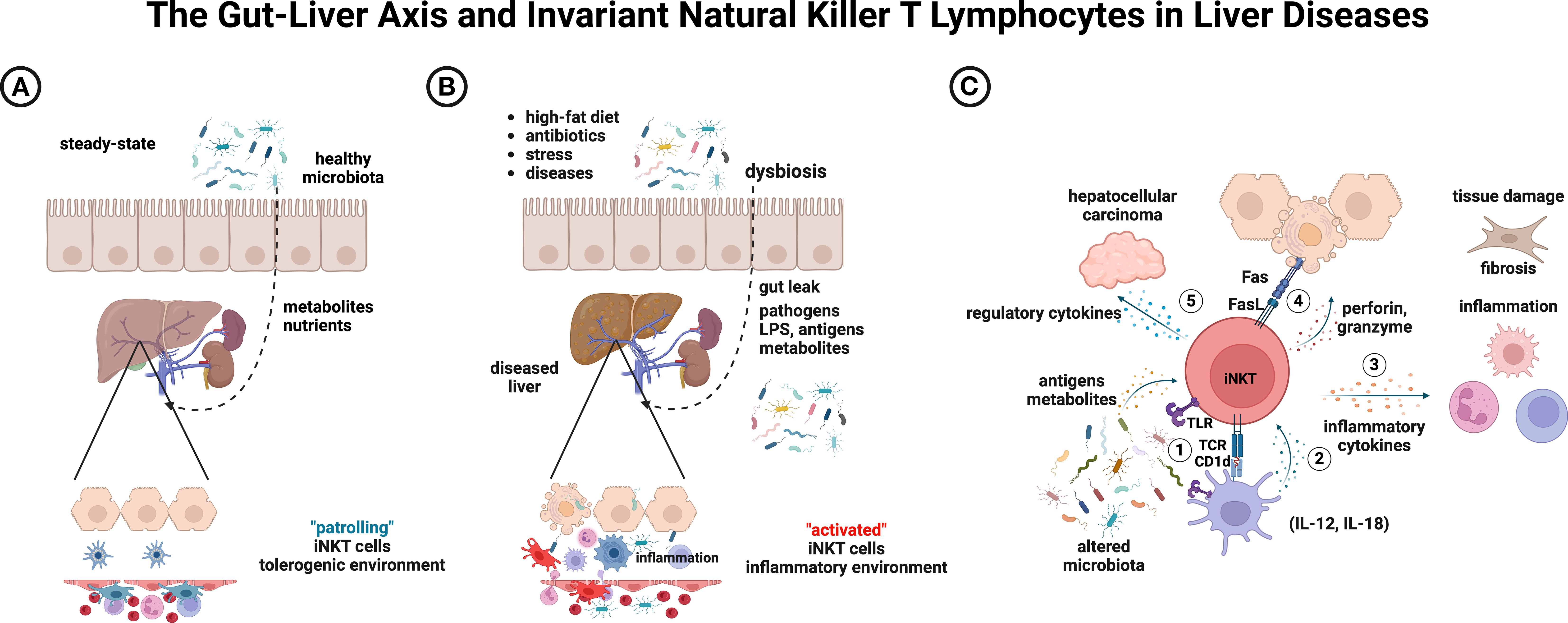 Diagram illustrating the gut-liver axis and invariant natural killer T (iNKT) cells in liver diseases. Panel A shows a healthy gut with steady-state microbiota interacting with the liver, promoting a tolerogenic environment. Panel B depicts dysbiosis from factors like high-fat diets and stress, leading to a diseased liver and inflammatory environment. Panel C illustrates iNKT cell activation by altered microbiota, resulting in inflammation, fibrosis, and possibly hepatocellular carcinoma. Elements like cytokines, antigens, and cell signaling processes are detailed to show disease progression.