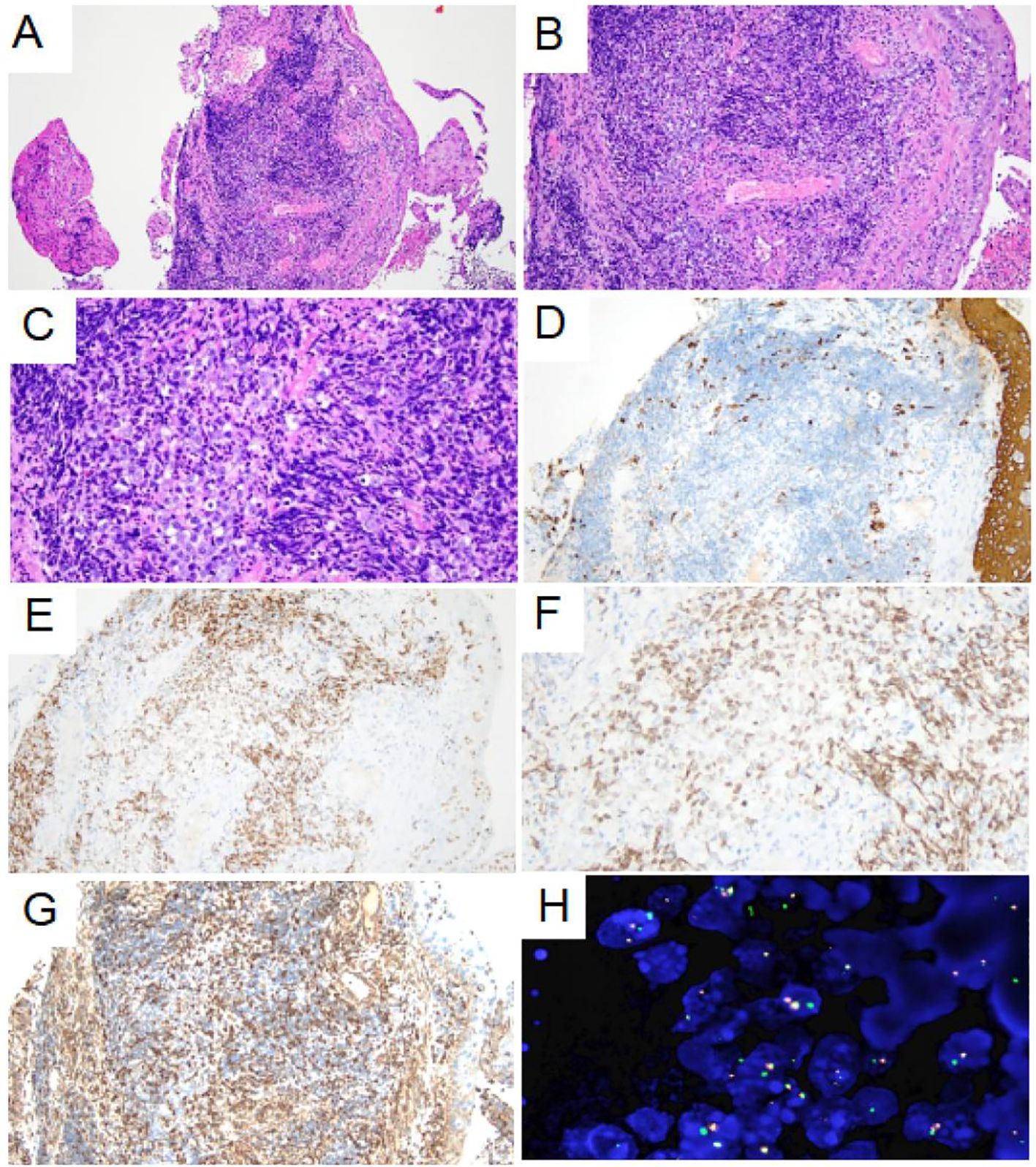 Microscopic images of tissue samples labeled A to H. Panels A, B, and C show dense clusters of purple and pink stained cells. Panel D presents cells with lighter blue and brown staining. Panels E, F, and G reveal variations of brown staining amidst lighter tissue. Panel H displays a high-magnification image with bright blue cells and green and red dots, likely markers for specific cellular components.