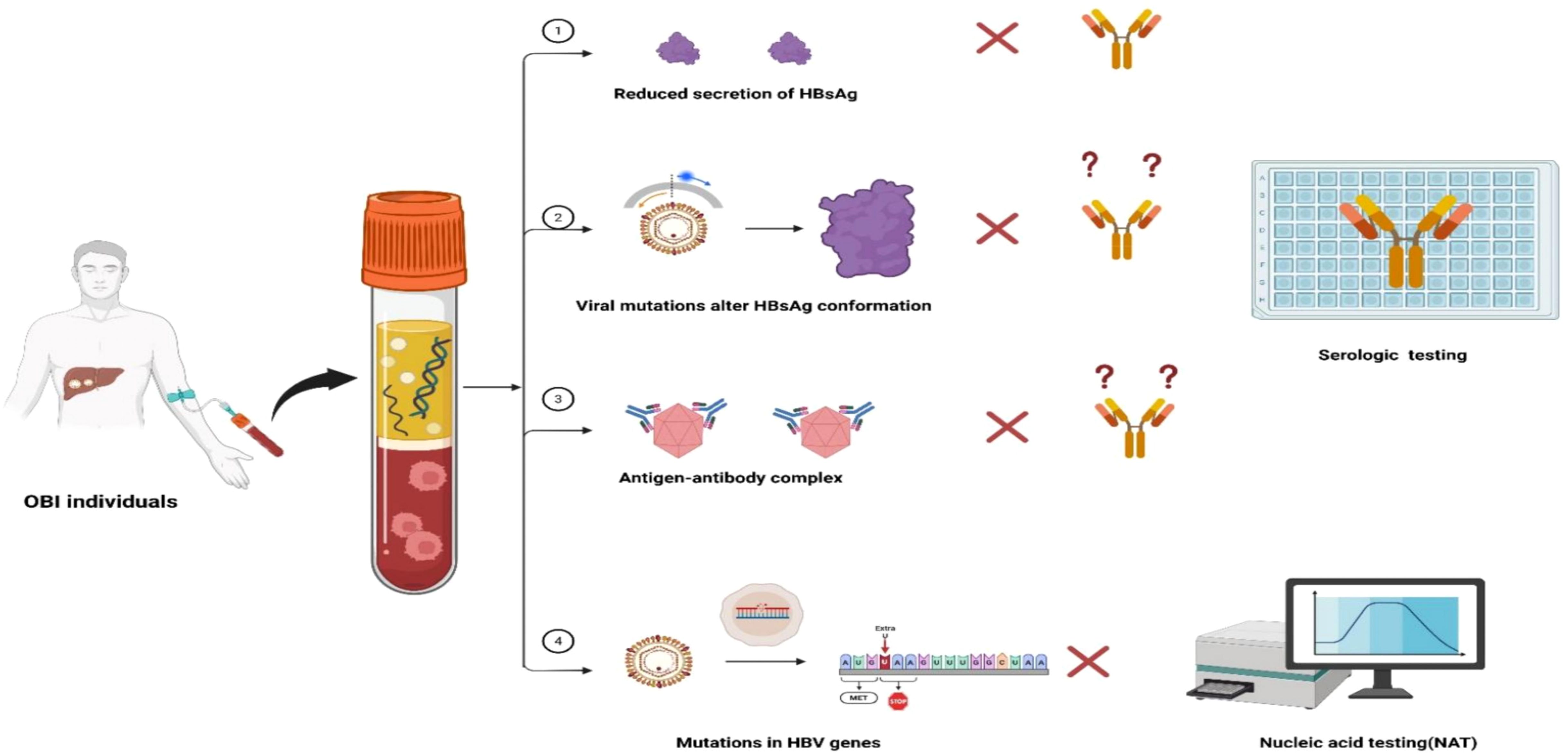Illustration showing factors impacting Hepatitis B virus (HBV) testing in OBI individuals. A blood sample is taken from a person and placed in a test tube. Four main issues affecting testing are depicted: 1) Reduced secretion of HBsAg; 2) Viral mutations altering HBsAg conformation; 3) Formation of antigen-antibody complexes; 4) Mutations in HBV genes. These factors lead to challenges in serologic testing and nucleic acid testing (NAT), highlighted by the inability to detect antibodies or viral genes accurately.