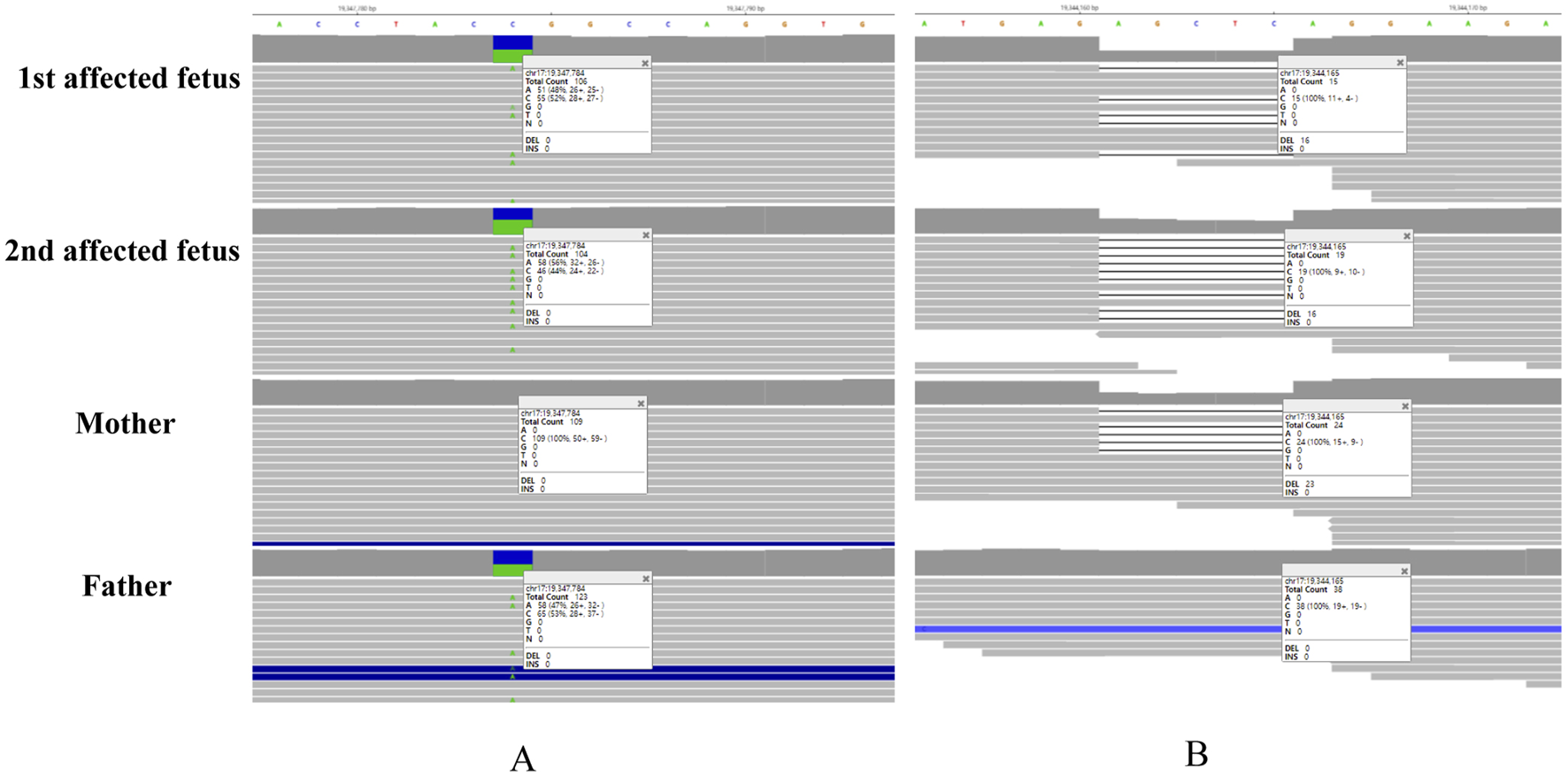 Genetic sequencing graphs comparing data from two affected fetuses, their mother, and father. Panel A shows sequence alignments with counts and minor alleles. Panel B illustrates similar data with a focus on deletions. Each row corresponds to a different individual.