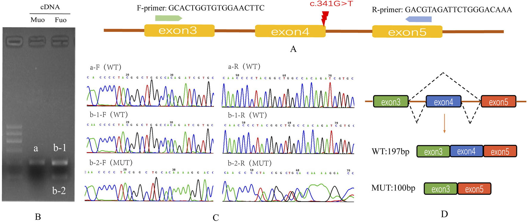 Gel electrophoresis and sequencing results: Part A shows exon arrangement and primers with a mutation marked c.341G>T in exon 4. Part B is a gel image with labeled bands: a, b-1, and b-2 for cDNA samples. Part C presents sequencing chromatograms for wild-type (WT) and mutant (MUT) samples, showing variations in nucleotide peaks between WT and MUT. Part D depicts exon schematic for WT and MUT, illustrating exon skipping in MUT, resulting in a shorter exon sequence (100bp) compared to WT (197bp).