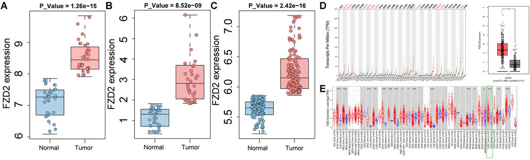 Box plots and graphs compare FZD2 expression in normal versus tumor tissues across multiple studies. Panels A, B, and C show higher expression in tumors with significant p-values. Panel D illustrates transcripts per million across different conditions, while panel E displays FZD2 expression levels in various tumor types compared to normals. Box plots indicate median, quartiles, and outliers.