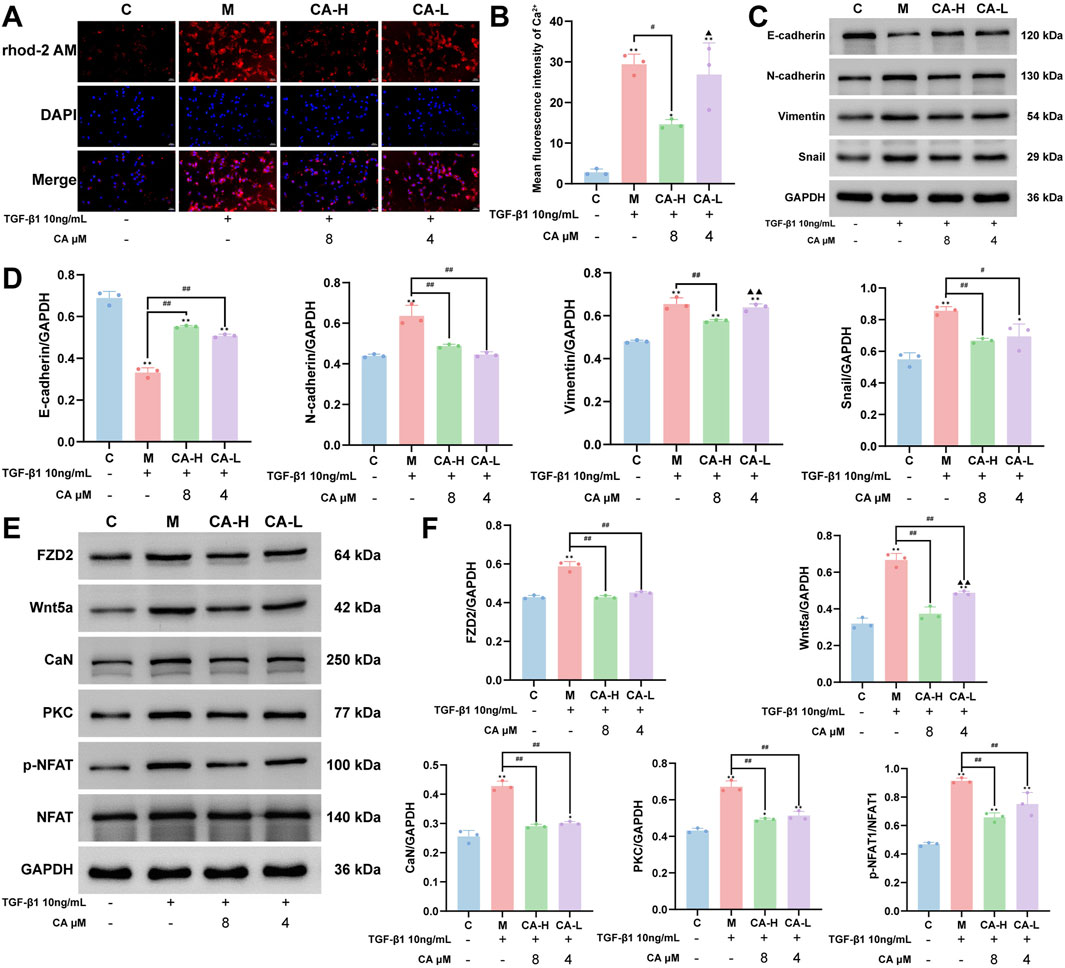 CA ameliorates EMT in MKN-45 by suppressing FZD2 and the Wnt5a/Ca2+/NFAT pathway. (A–B) Immunofluorescence of MKN-45 Ca2+ with CA and statistics (N=3). (C–D) Western blots of EMT markers after CA treatment and their quantification (N=3). (E–F) Western blots showing CA regulation of FZD2 and key Wnt5a/Ca2+/NFAT pathway proteins, with corresponding statistics (N=3). Compared with the group C, * p < 0.05, ** p < 0.01. Compared with the group M, #p < 0.05, ##p < 0.01. Compared with the group CA-H, ▲p < 0.05, ▲▲p < 0.01.