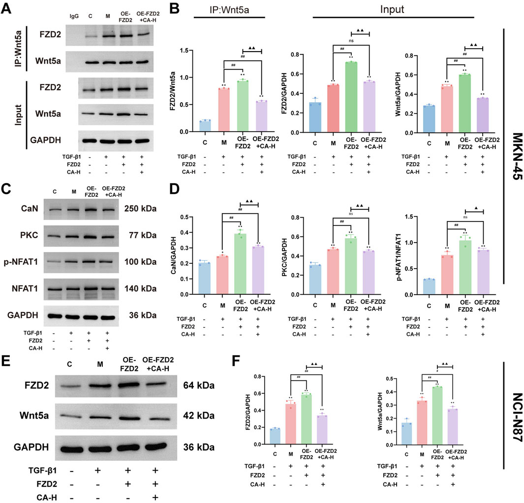 Western blots and bar graphs illustrating protein expression in MKN-45 and NCI-N87 cell lines. Panels A and E show blots for proteins FZD2, Wnt5a, CaN, PKC, NFAT1, and p-NFAT1, with GAPDH as a loading control. Panels B, D, and F display quantified bar graphs of protein expression levels, comparing conditions with TGF-β1, FZD2 overexpression, and CA-H treatment. Statistical significance is indicated by asterisks and hash marks. Panel labels include IP: Wnt5a, Input, and additional conditions.