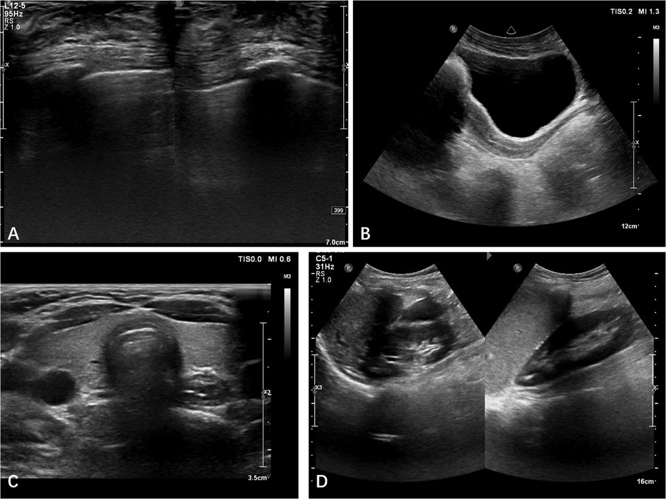 Four-panel ultrasound images: Panel A shows a transverse view of tissue layers. Panel B depicts a sagittal view with a large, dark anechoic area. Panel C shows a cross-sectional view of a round structure within tissue. Panel D presents two similar views with varying internal features, likely of an organ or anatomical structure.