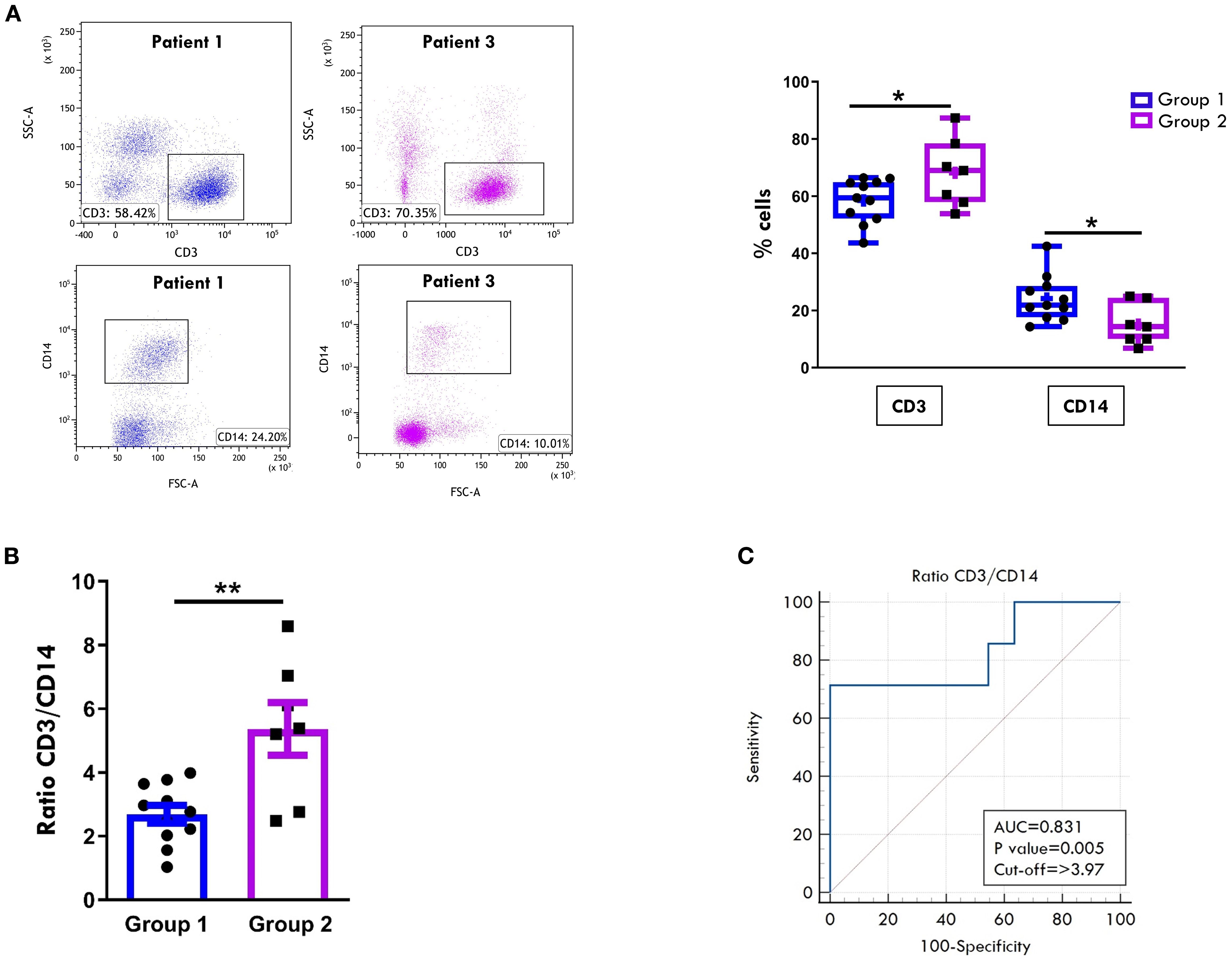 Graphs and plots depicting T cell and Mn data in SF from two patient groups. Panel A shows flow cytometry dot plots for CD3 and CD14 expression in patient one representative of Group 1 and patient three representative of Group 2 with percentages indicated. Box plots compare the percentage of CD3 and CD14 cells in Group 1 and 2, showing statistical significance. Panel B depicts a bar chart comparing the CD3/CD14 ratio between Group 1 and Group 2, indicating a significant difference. Panel C presents a ROC curve for the CD3/CD14 ratio with an AUC of 0.831, a p-value of 0.005, and a cut-off of greater than 3.97. Group 1 is indicated by blue markers, group 2 by purple markers.