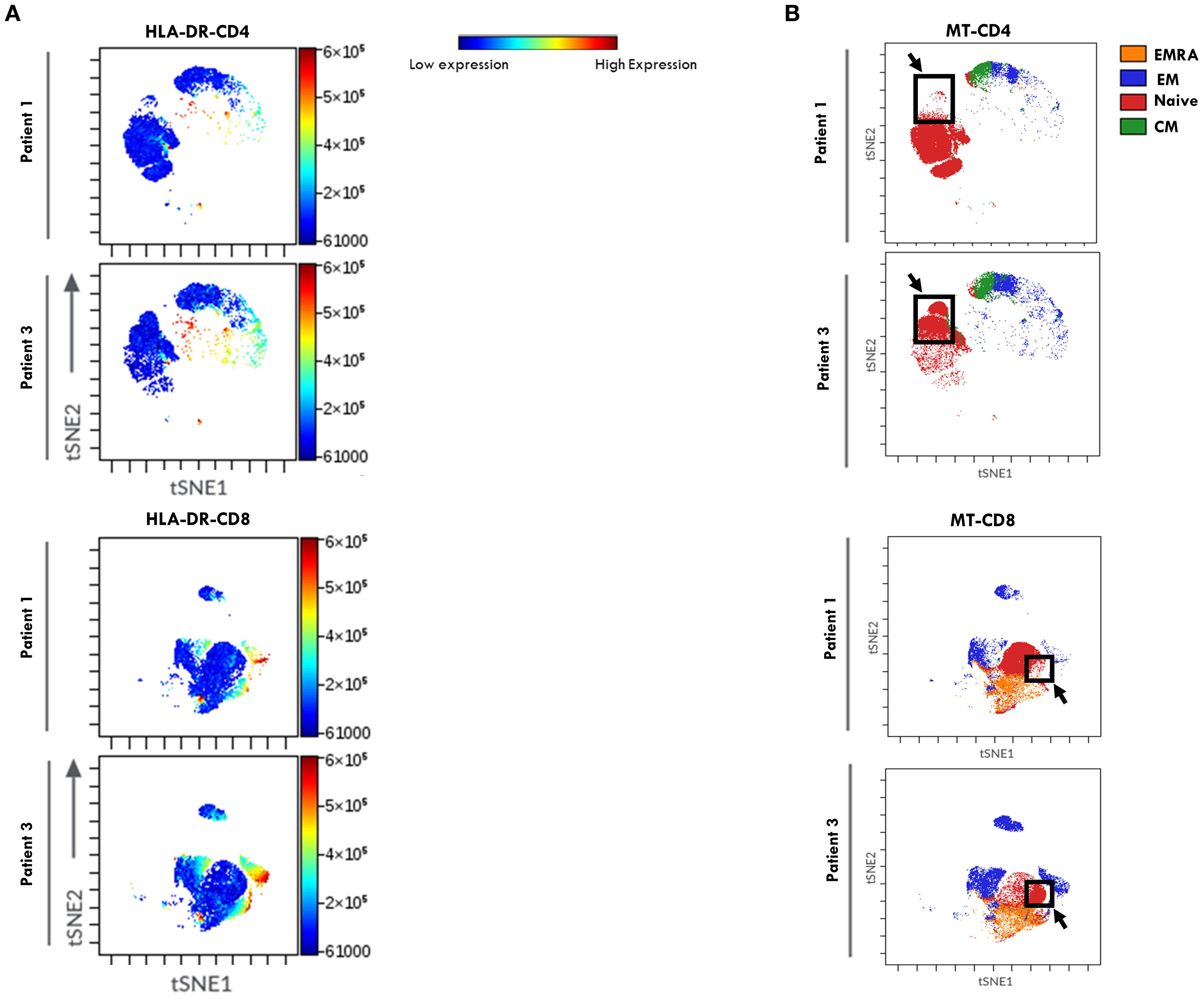 Panel A displays viSNE plots for HLA-DR-CD4 and HLA-DR-CD8 expression in PB from representative patients one and three, indicated by color gradients from blue to red, representing low to high expression. Panel B presents FlowSOM clustering plots of MT-CD4 and MTCD8 cells for the same patients, showing EMRA, EM, Naive, and CM subsets in different colors, with arrows pointing to specific clusters.
