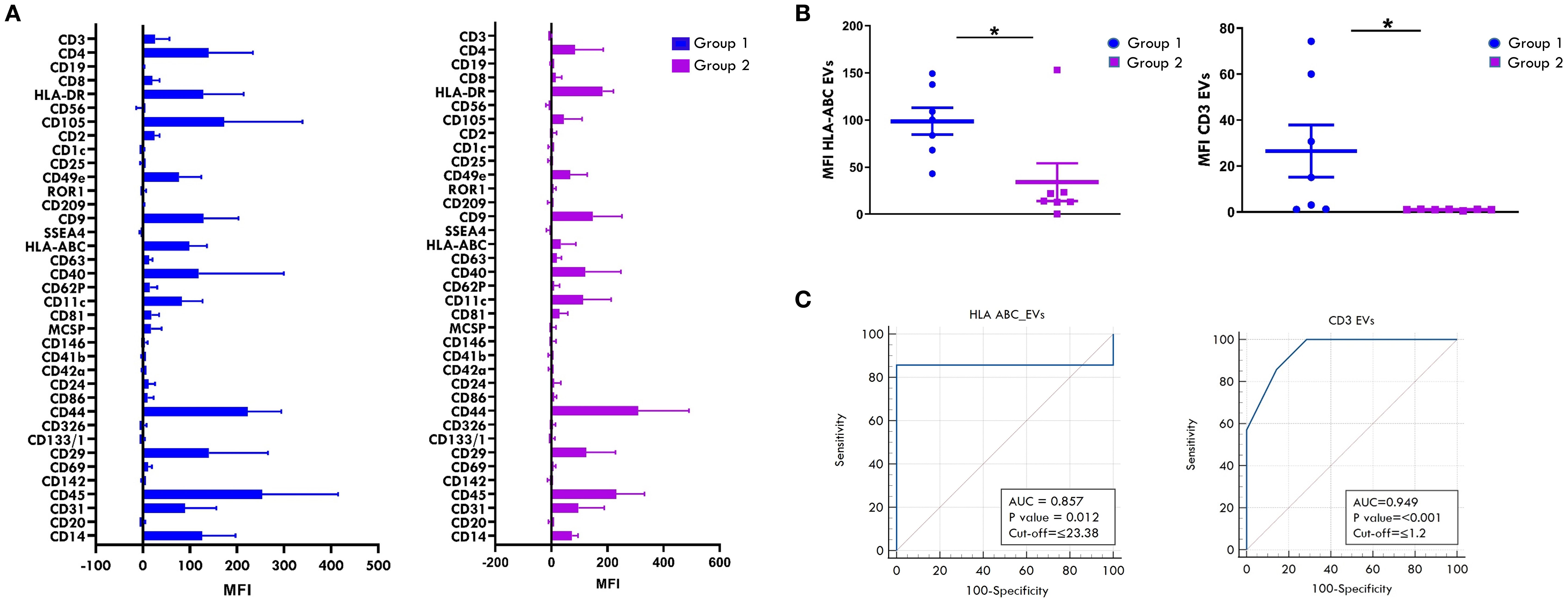 Panel A presents bar graphs comparing mean fluorescence intensity (MFI) of various markers on SF-derived EVs between the two groups of patients, depicted in blue and magenta, as determined by MACSPlex analysis. Panel B shows scatter dot plots comparing MFI of HLA-ABC and CD3 in patients from Groups 1 and 2, with significant differences between groups. Panel C shows ROC curves for HLA-ABC and CD3 markers expression levels, with significant area under curve (AUC), p-values, and cut-off values indicated.
