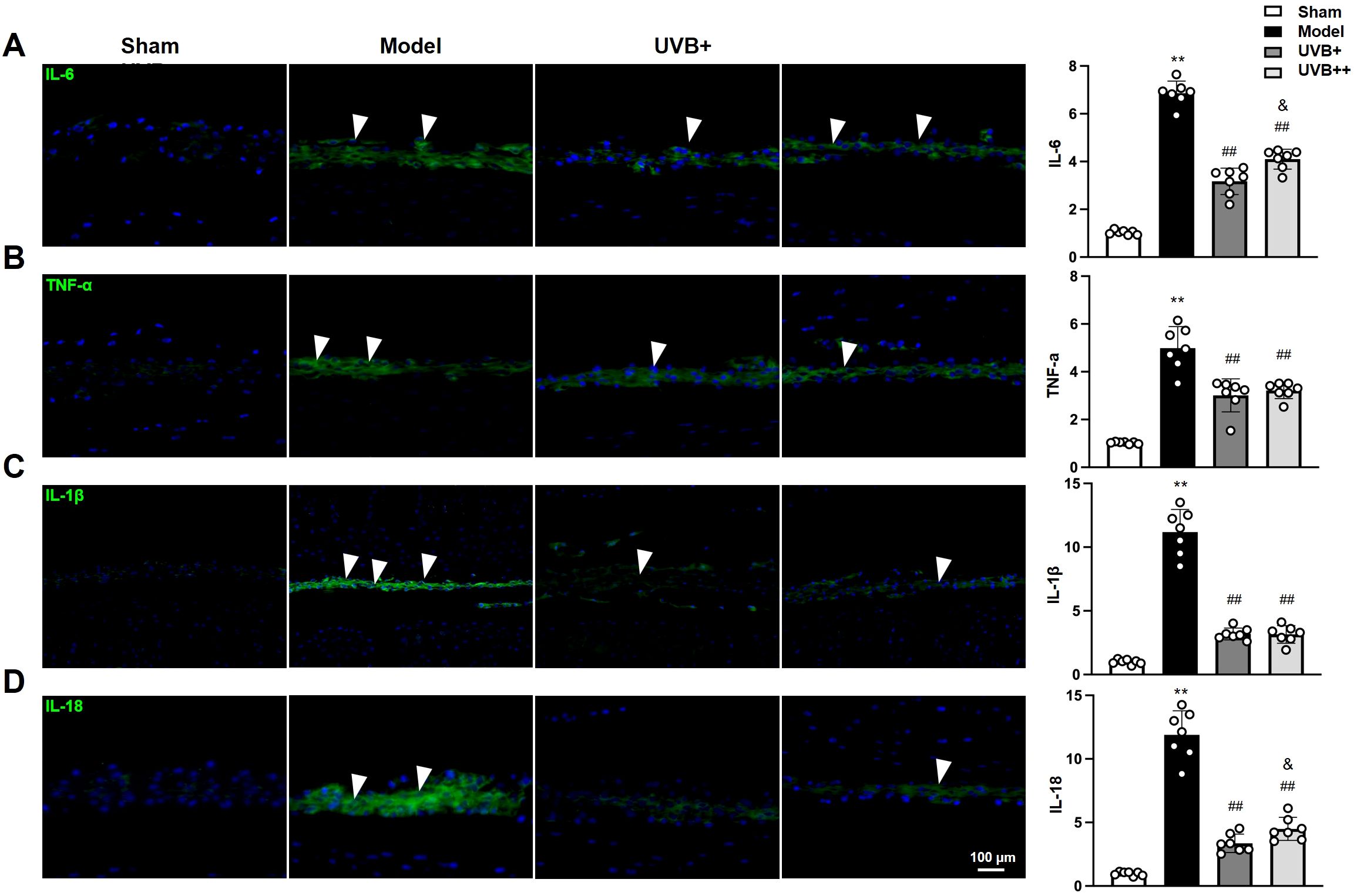 Fluorescent micrographs and bar graphs showing the expression of inflammatory markers in skin tissue under different conditions: Sham, Model, UVB+, and UVB++. Panels A to D display IL-6, TNF-α, IL-1β, and IL-18 stains, respectively, with increased fluorescence indicated by arrowheads in Model and UVB+ groups. Bar graphs quantify the expression levels, with notable increases in Model and UVB+ conditions compared to Sham. Statistical markers such as **, ##, and & indicate significance levels. Scale bar represents one hundred micrometers.