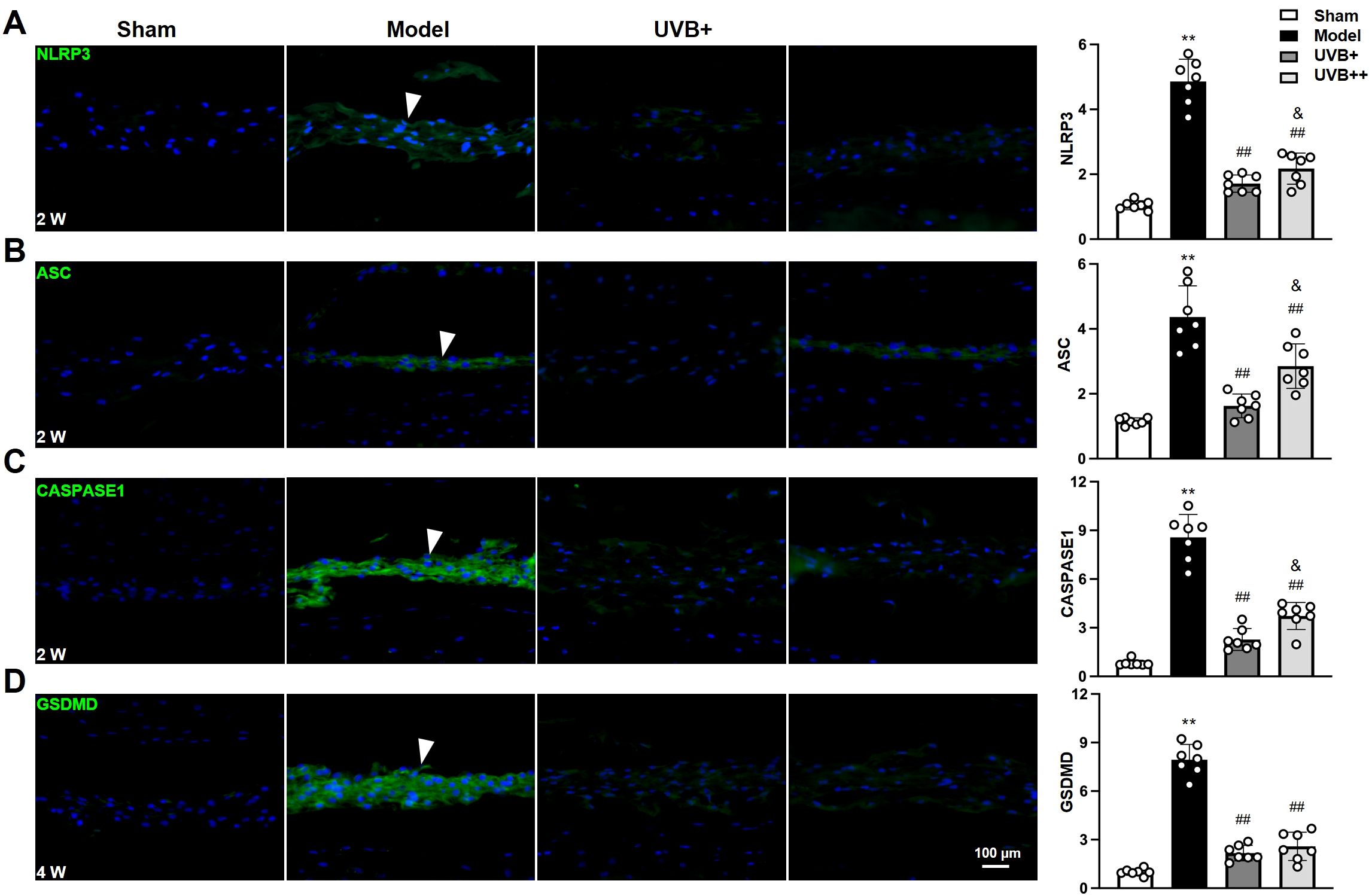 Fluorescence images and bar graphs depict protein expression in skin tissues after different treatments including Sham, Model, and UVB+. Panel A shows NLRP3, Panel B shows ASC, Panel C shows CASPASE1, and Panel D shows GSDMD, each at 2 or 4 weeks. The bar graphs on the right quantify the expression levels, with the model group showing significantly higher expression compared to others. Statistical markers are present for significance. Scale bar is 100 micrometers.