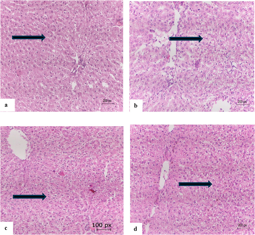 Histological images of liver tissue under a microscope, labeled a, b, c, and d. Each panel shows pink-stained cells with varying densities and structures. Arrows indicate the direction of tissue organization. Scale bars in panels a, b, and d are 200 pixels, while panel c is 100 pixels.