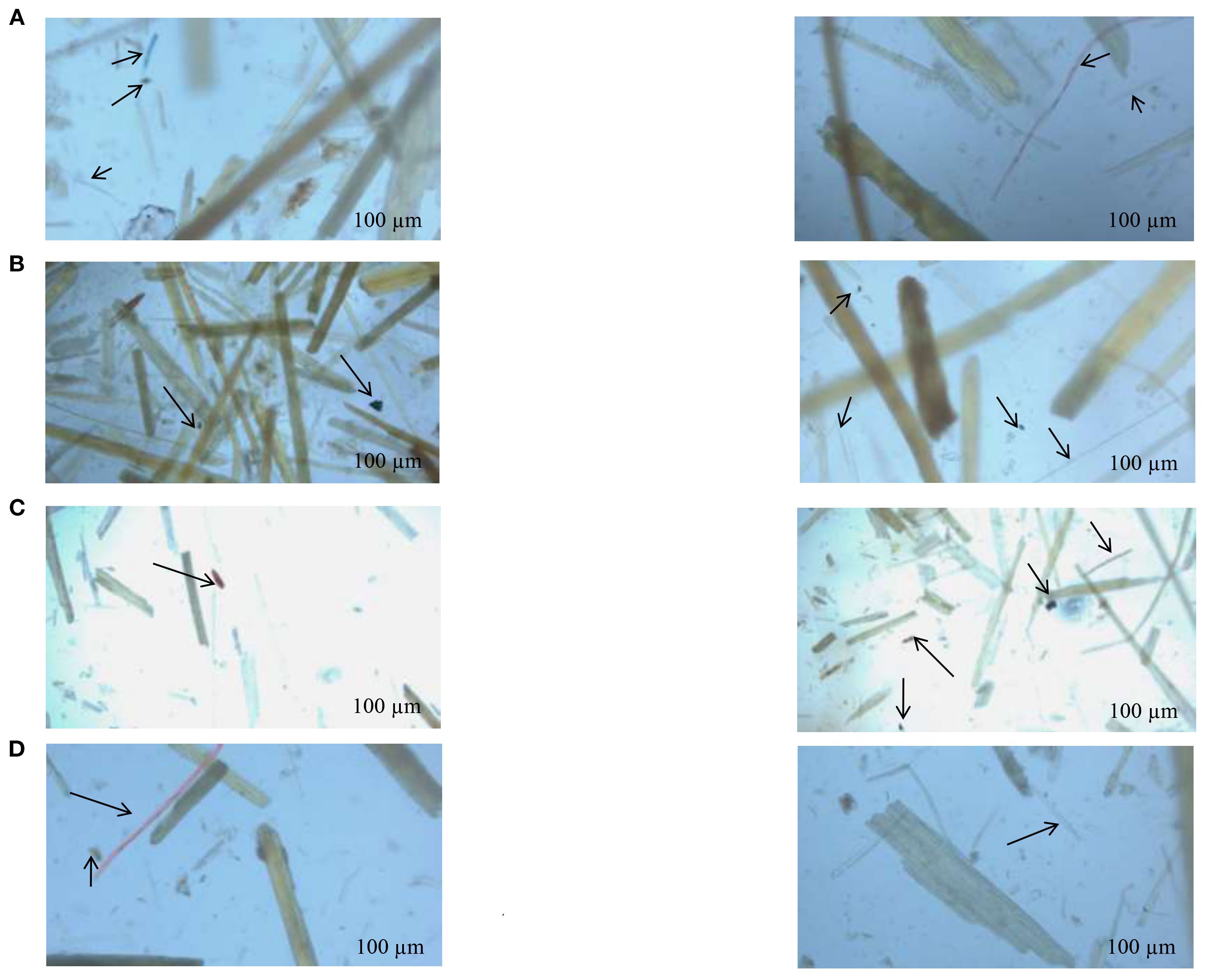 Microscopic images labeled A to D, showing elongated fibrous structures under magnification. Black arrows indicate specific fibers. Each sub-image includes a scale bar measuring one hundred micrometers for reference.