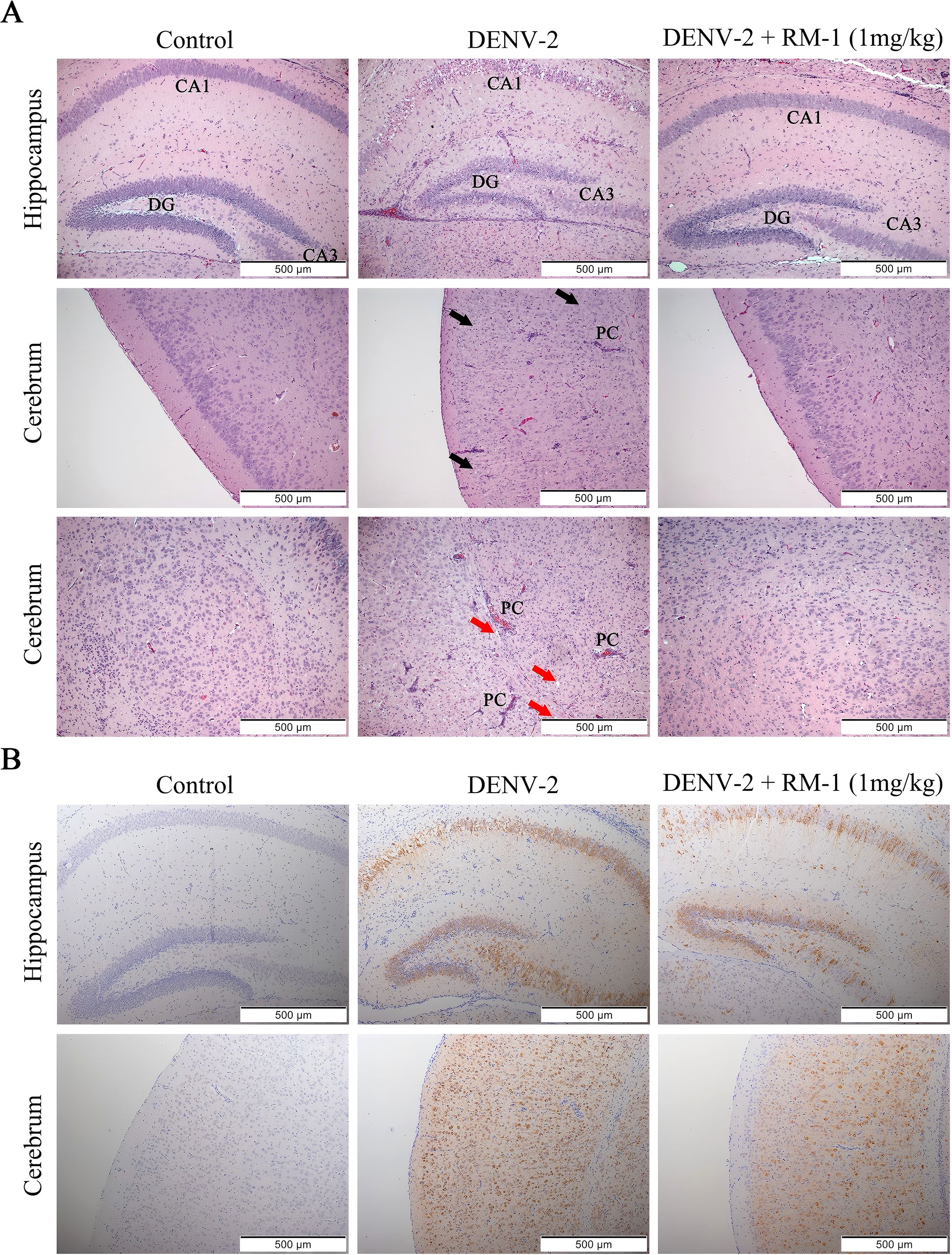 Histological images showing the effects of DENV-2 and DENV-2 with RM-1 on the hippocampus and cerebrum. Panel A displays the hippocampus and cerebrum under three conditions: Control, DENV-2, and DENV-2 with RM-1 (1 mg/kg), highlighting cellular structures like CA1, DG, and CA3 in the hippocampus, and PC in the cerebrum with arrows indicating affected areas. Panel B shows the same conditions with staining differences, focusing on the distribution of cells in the hippocampus and cerebrum. Scale bars indicate 500 micrometers.