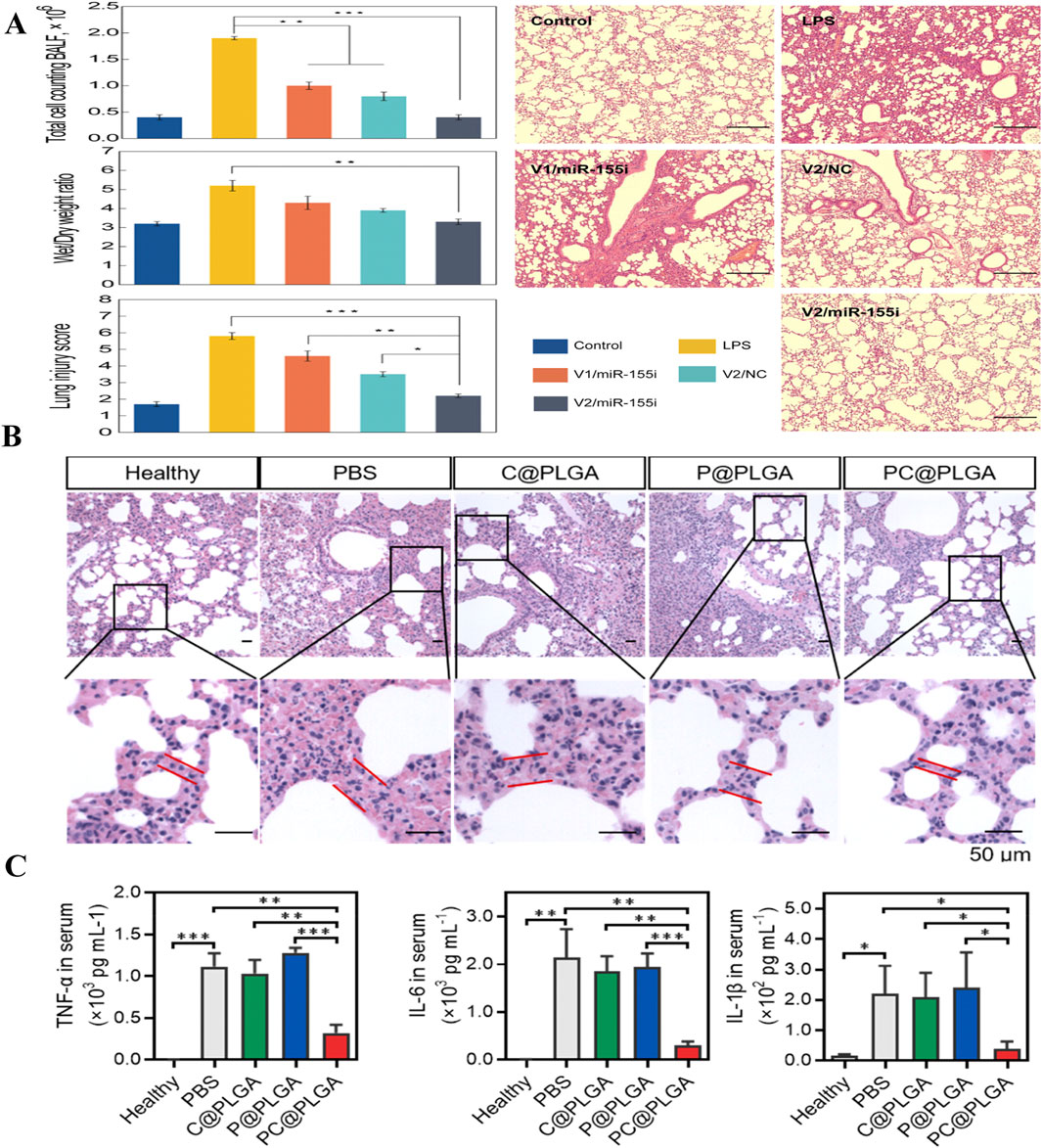 Panel A shows bar charts and lung tissue images comparing effects of treatments like LPS and various miR-155i combinations on cell count, weight ratio, and injury score. Panel B presents histological images of lung tissues under different treatments including healthy control, PBS, and various PLGA formulations, with zoomed-in sections. Panel C displays bar graphs depicting serum levels of TNF-alpha, IL-6, and IL-1beta across different treatment groups, highlighting significant differences. Scale bars are included for reference.